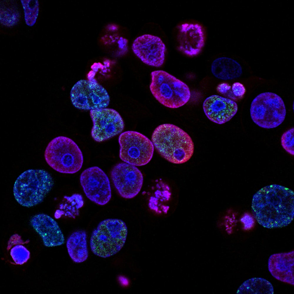 purple cells photo