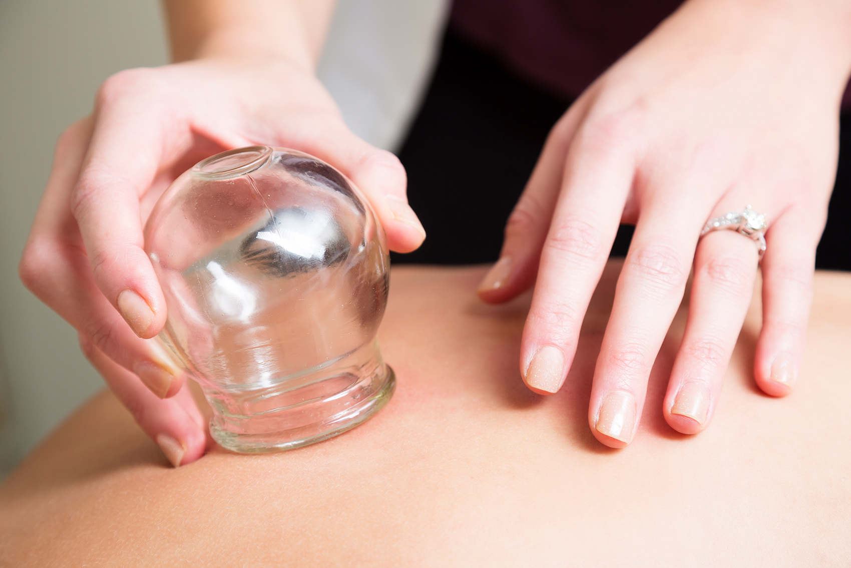 Therapeutic Massage Cupping