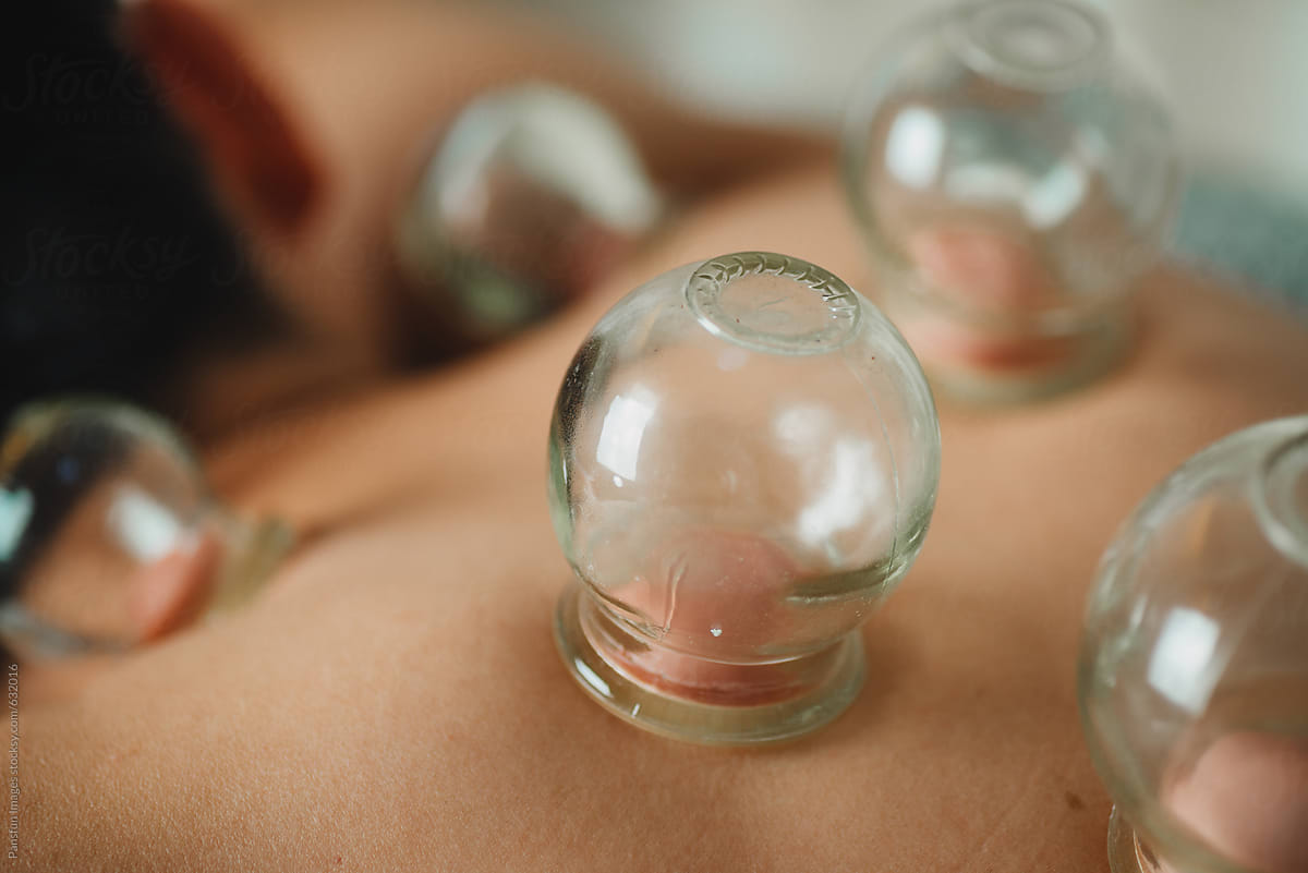 Glass Cupping Therapy