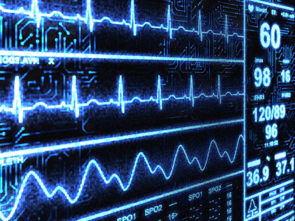 Applying Artificial Intelligence to Anesthesia Information Management Systems Anesthesia Services. OBS Anesthesia Management Groups