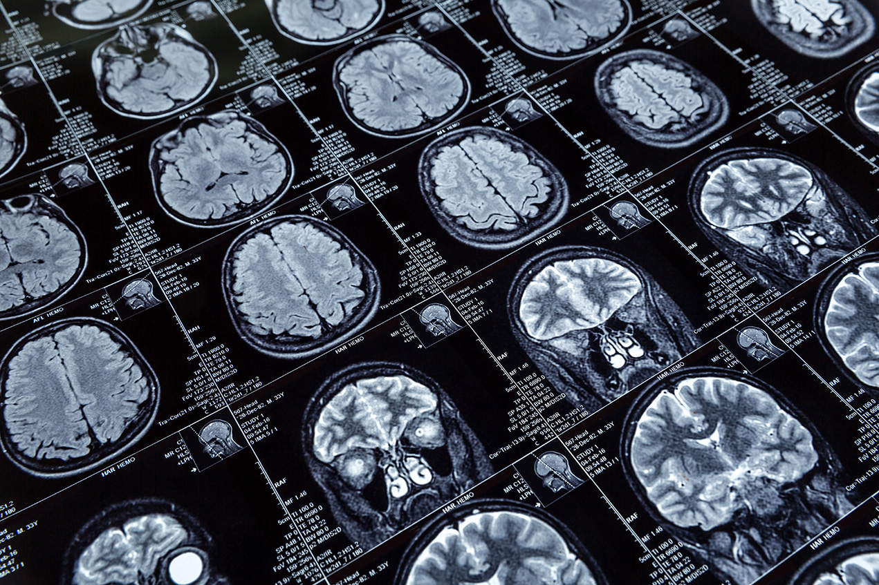 Neurodiagnostics Archives - SpecialtyCare