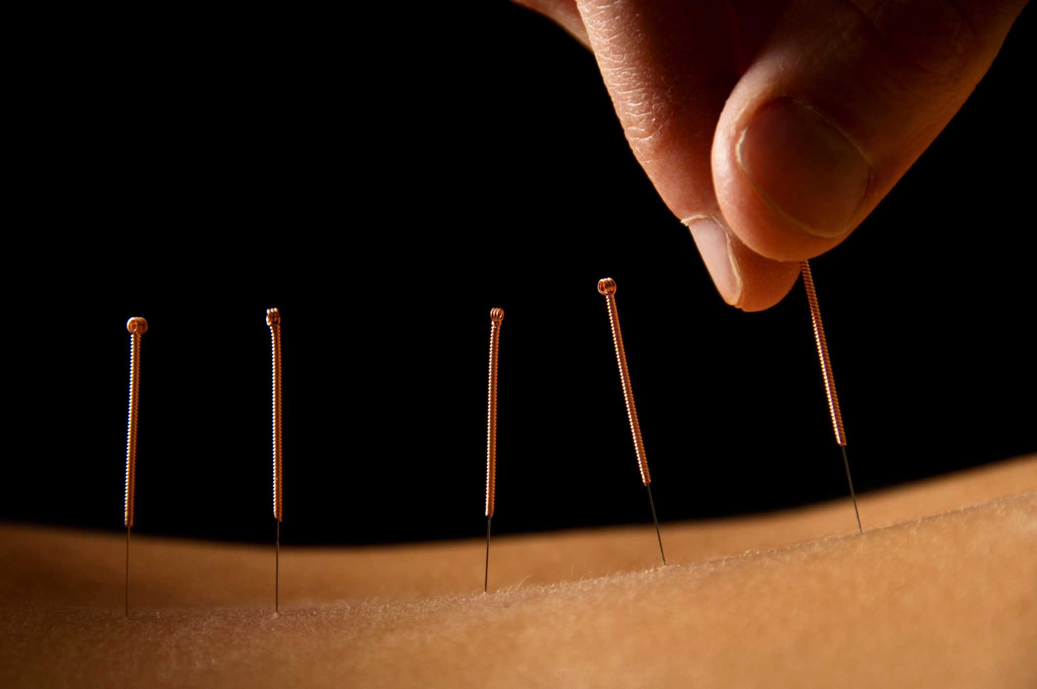 Acupuncture Wallpapers Wallpaper Cave