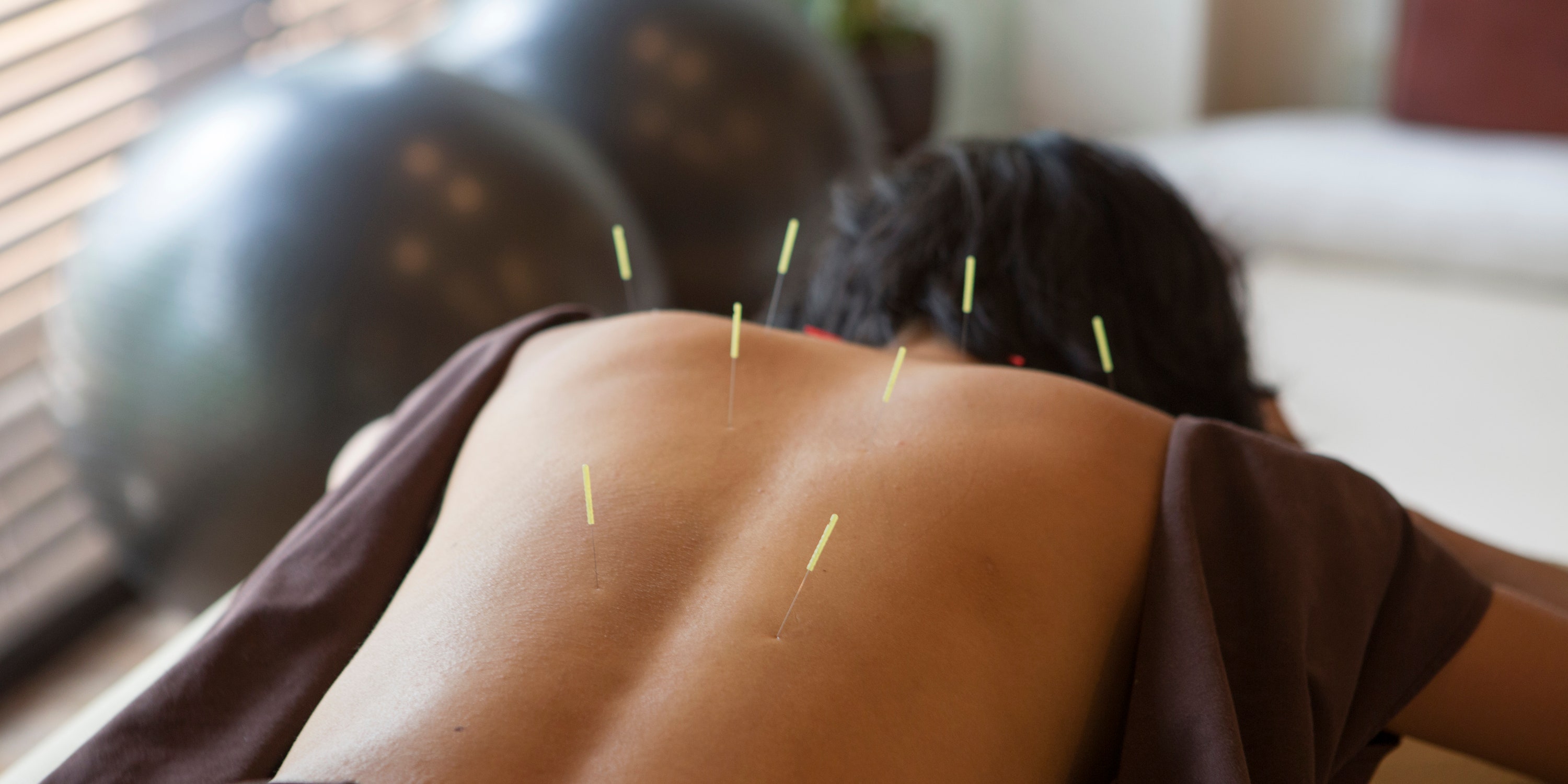 Acupuncture Terms to Know Before Your First Appointment