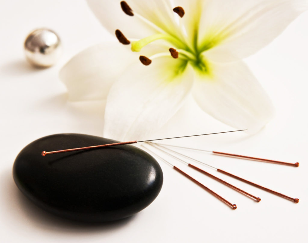 Free Intro to Acupuncture Workshop Place Wellness Center, Framingham