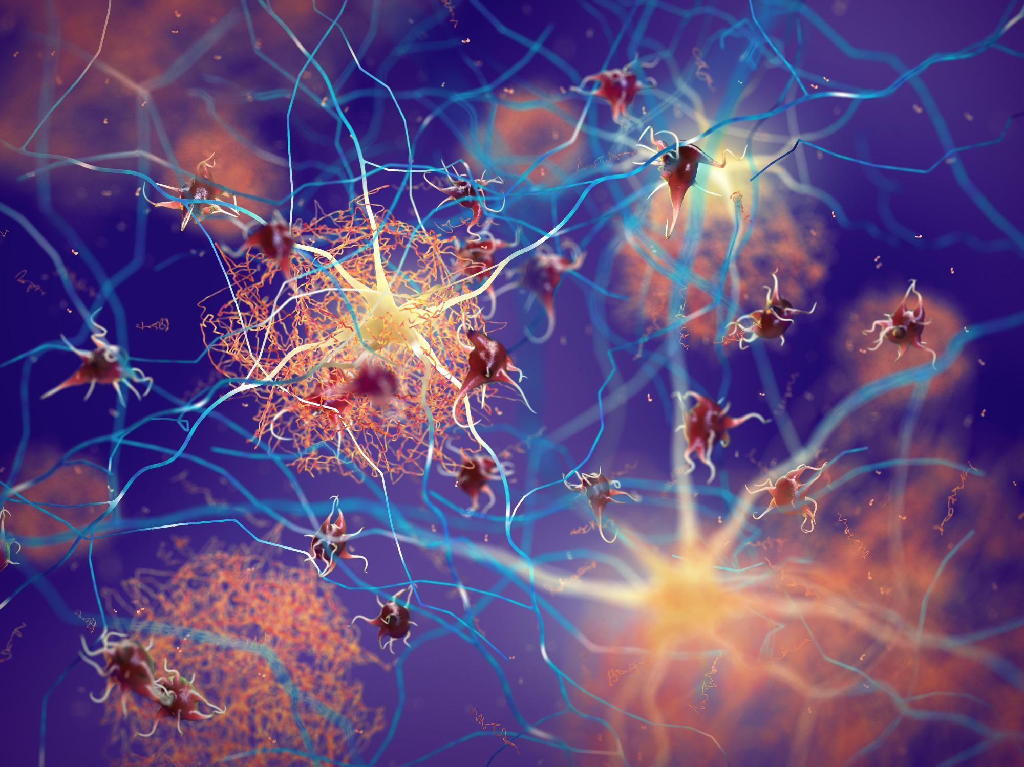 How Nanotechnology can Enable Testing for Early Alzheimer's Disease