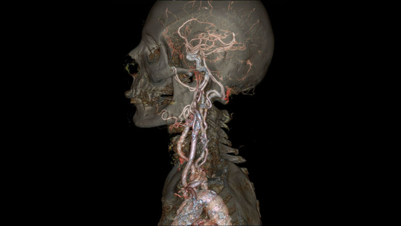 GE's New Fast CT Scanner Captures Insane Image In A Heart Beat