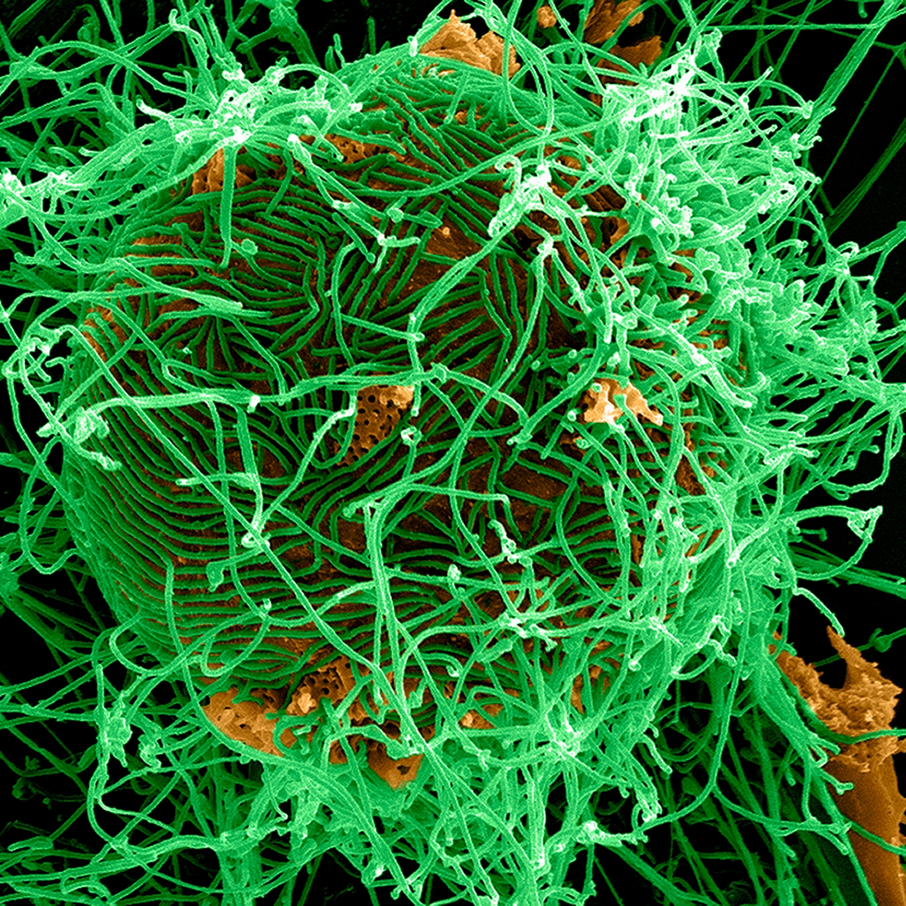 Ebola virus facts and information