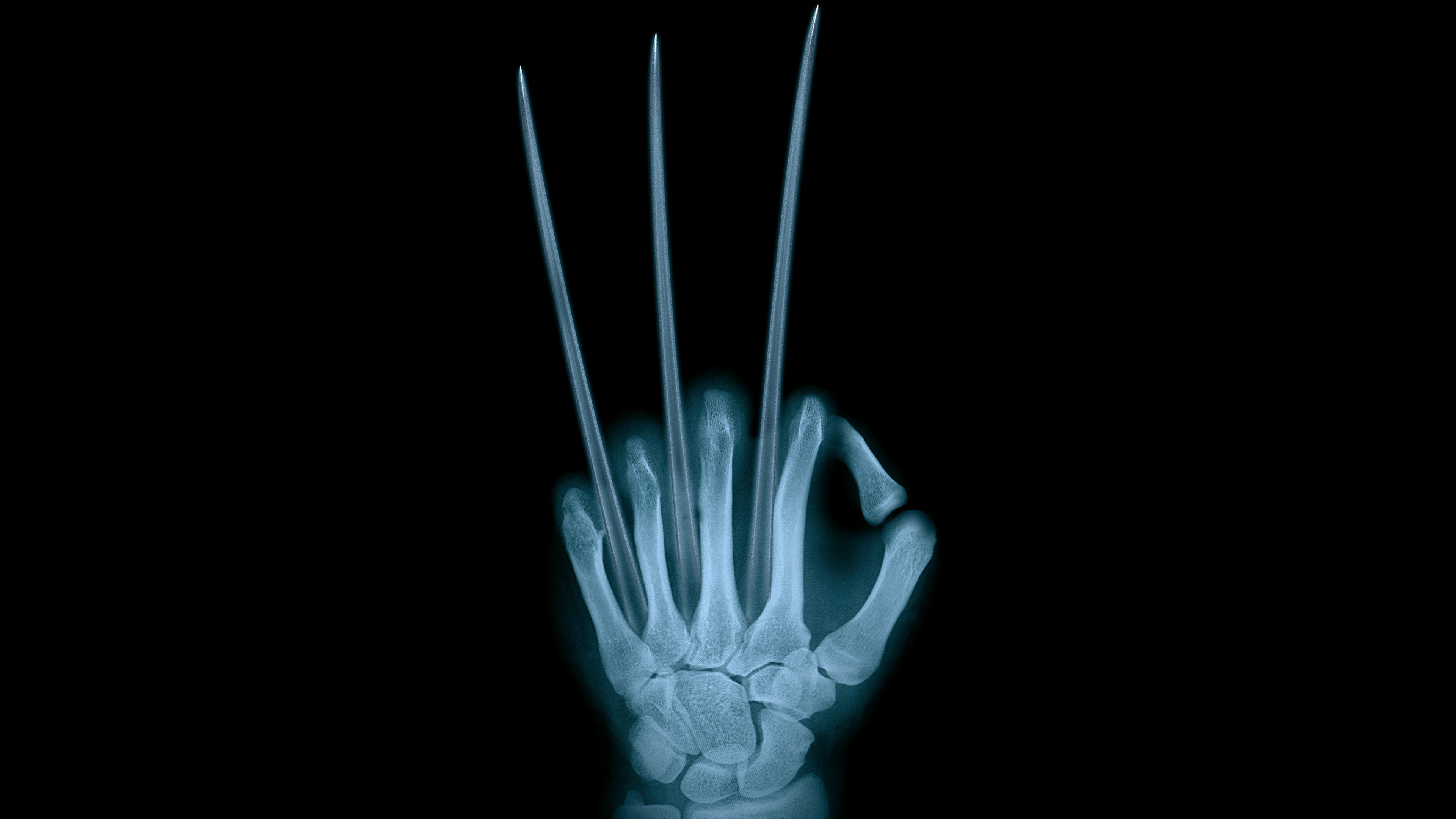 x ray wallpaper, radiography, x ray, medical, hand, still life photography