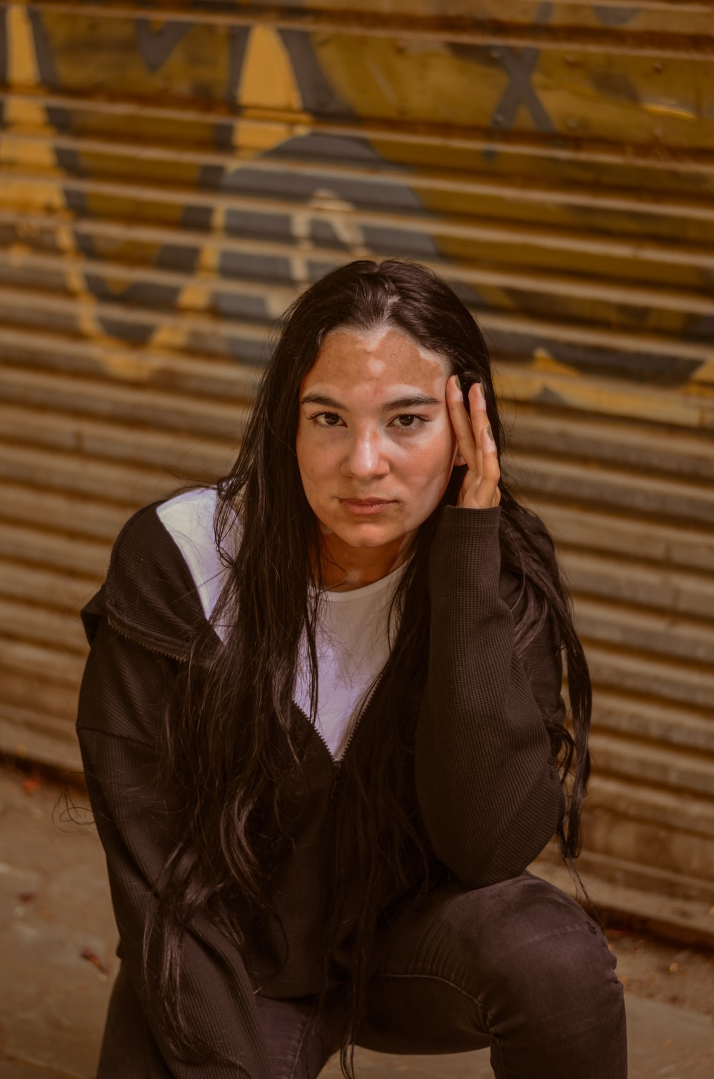 Vitiligo Picture. Download Free Image