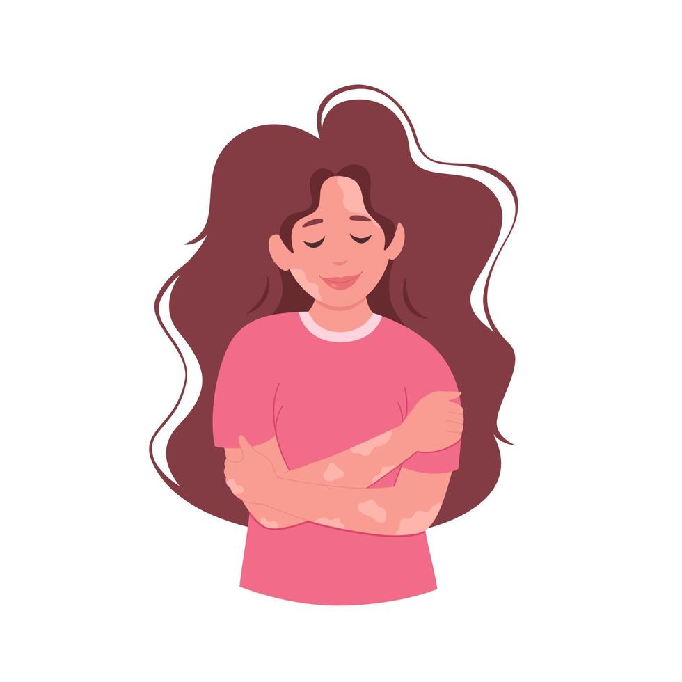 Woman with vitiligo. World vitiligo day. Self care, self love, body positive