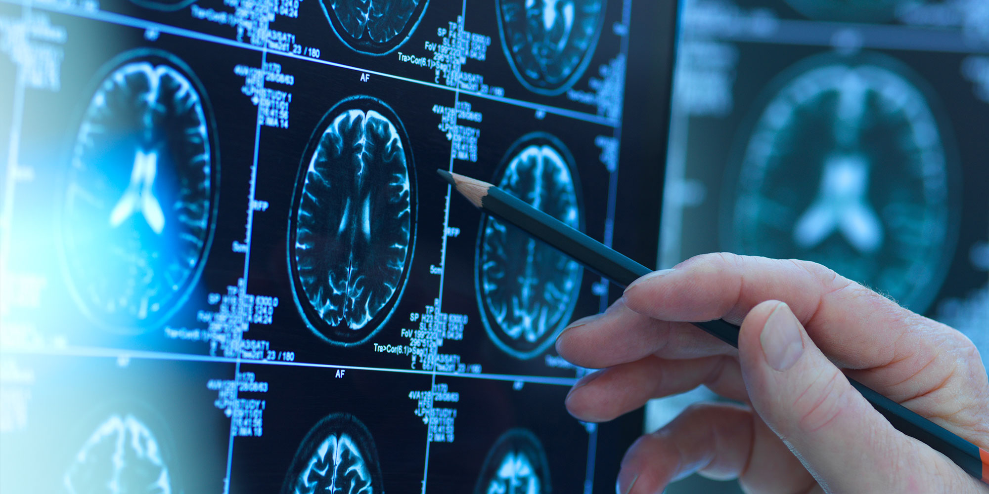 Neurological Rehabilitation. Sunnyview Rehabilitation Hospital. Schenectady, NY