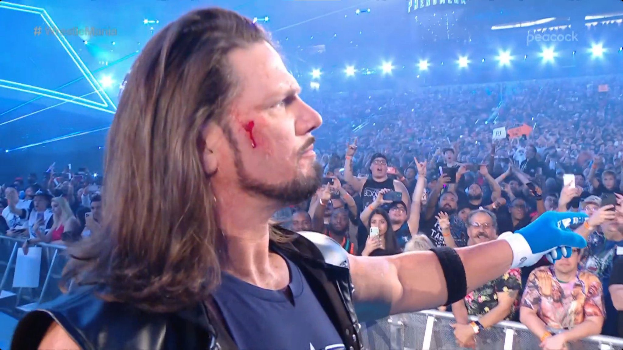 Nils Suling Styles blutet vorm Kampf! AJ Styles is bleeding his match! What happened? #Wrestlemania