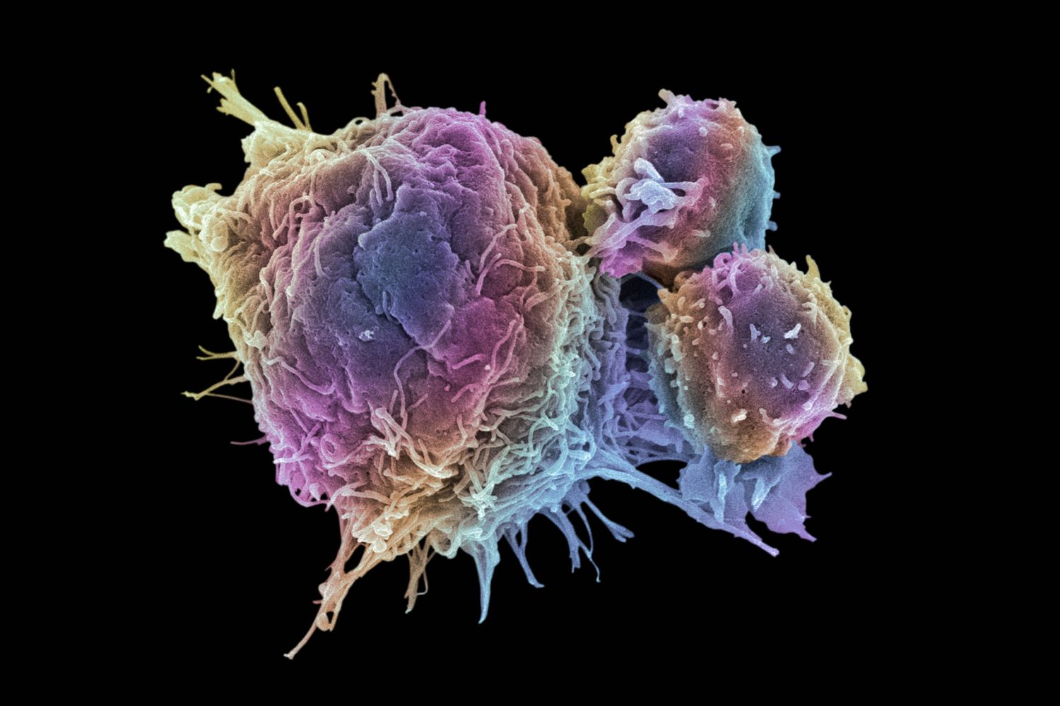 Cancer Cells vs. Normal Cells: How Are They Different?