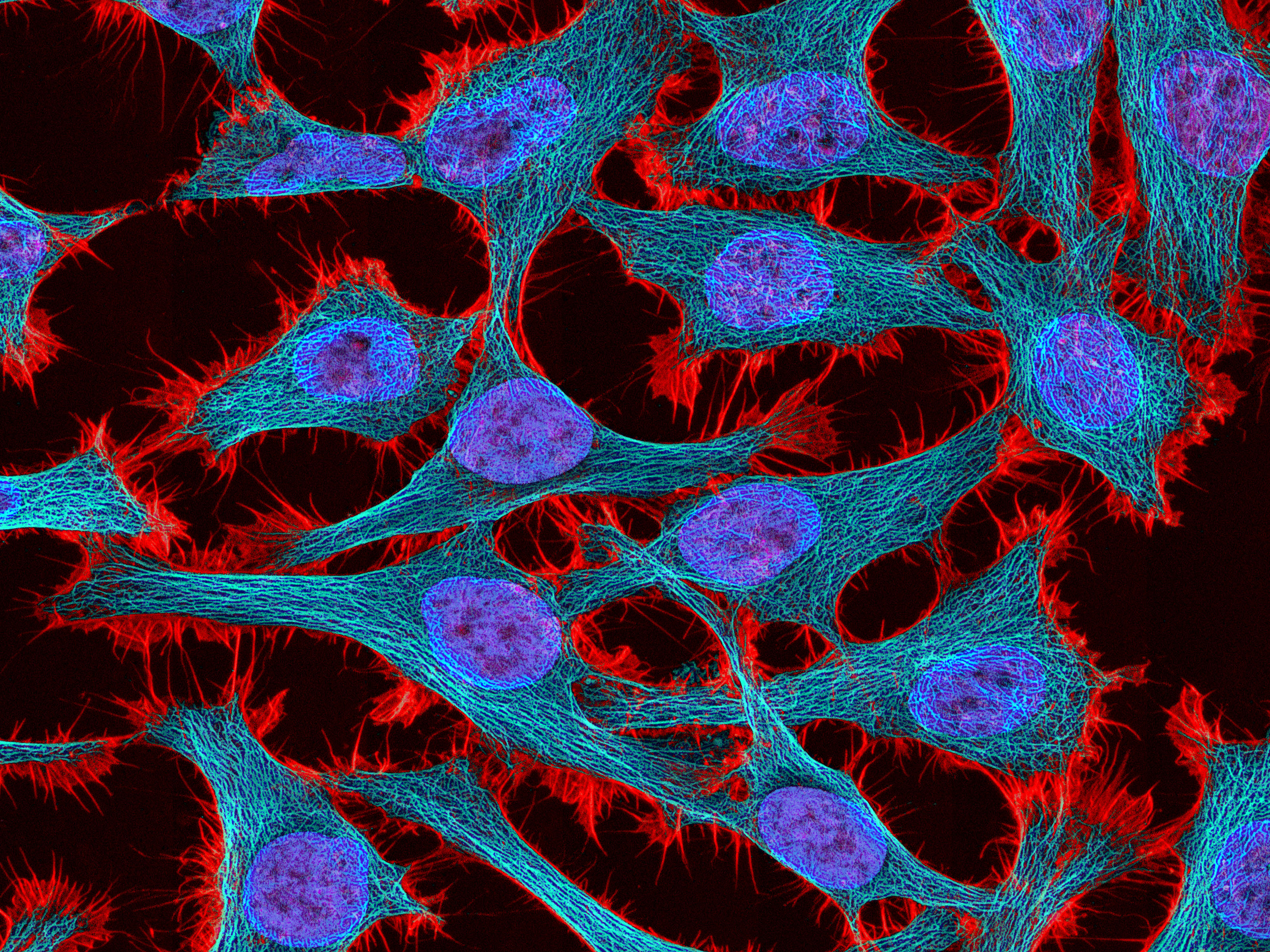 HeLa Cells: Image Details Visuals Online