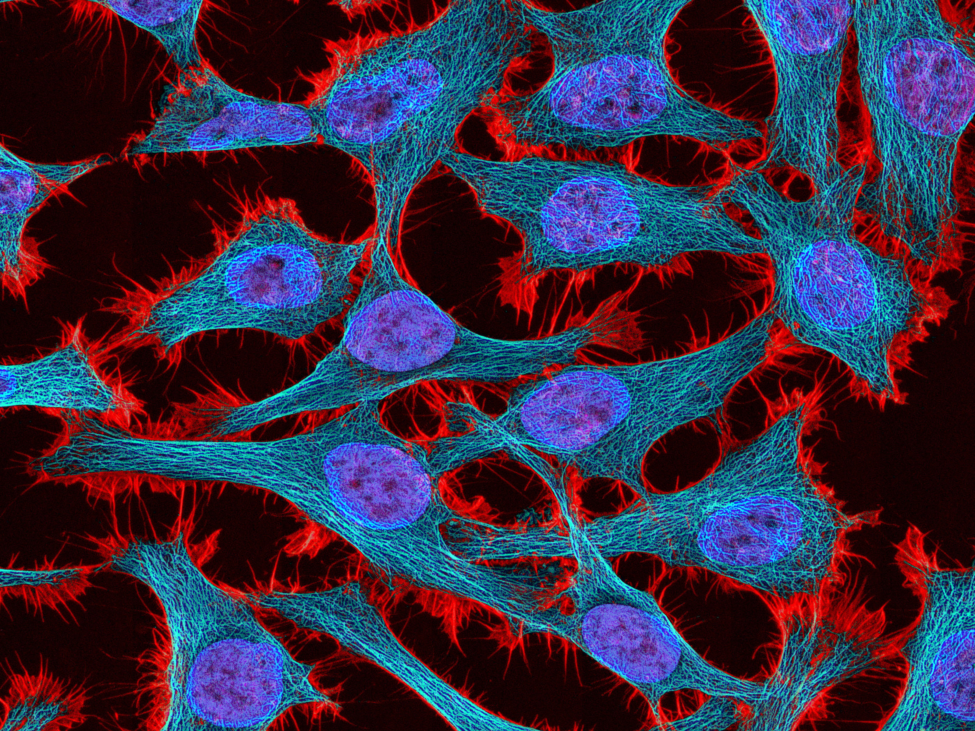 HeLa Cells: Image Details Visuals Online