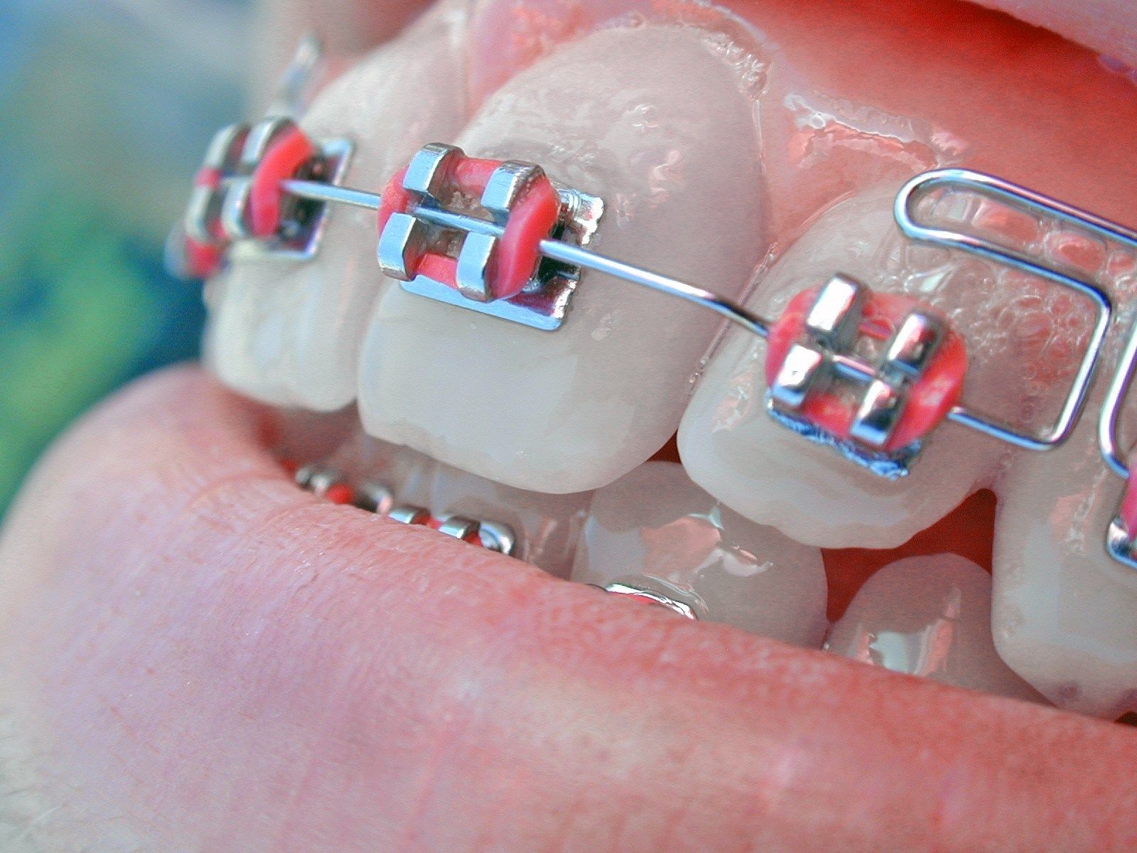 Orthodontics Wallpaper Free Orthodontics Background