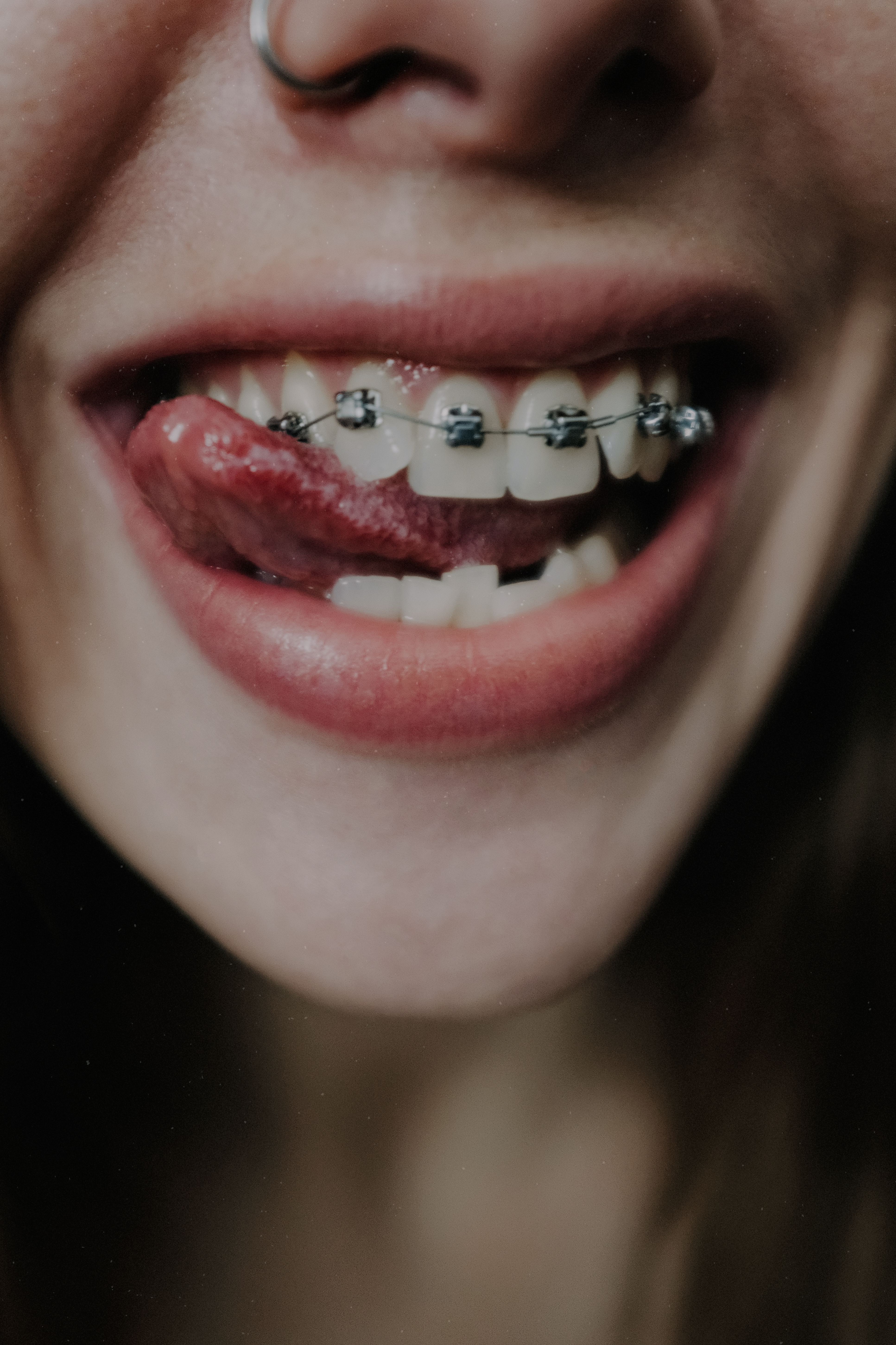 Crop coquettish smiling woman with teeth braces · Free