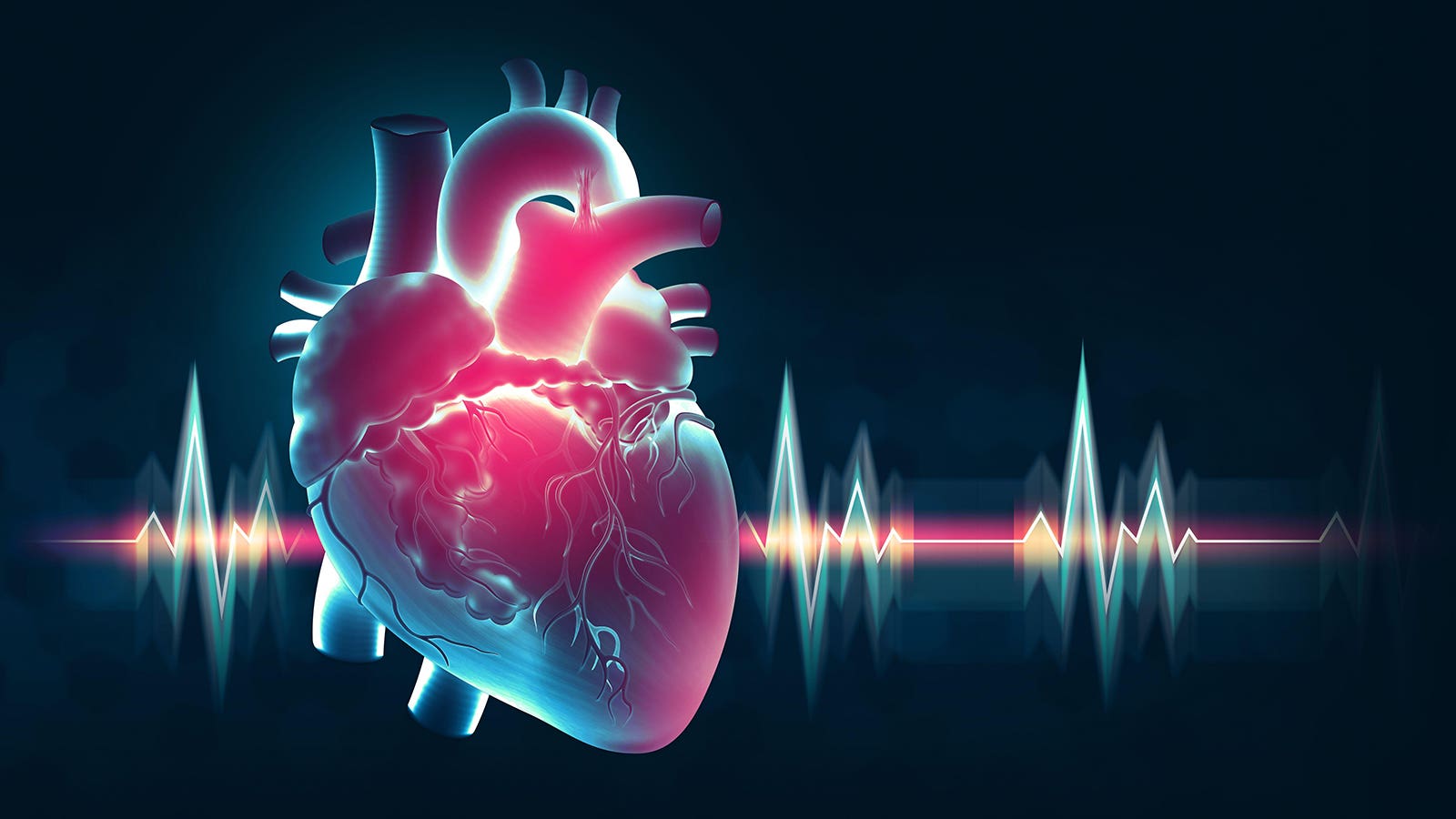 Early Cardiac Amyloidosis Still Bad News Without Treatment