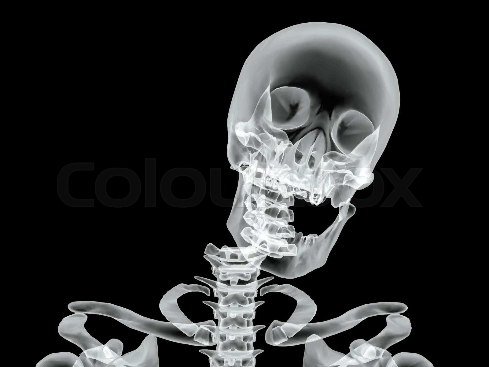 Vector Broken Bone X Ray Image