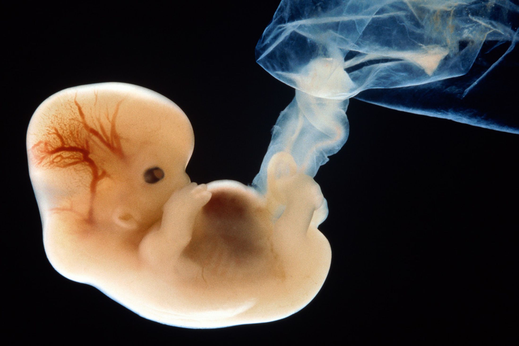 Fly Through the Nervous System of a 7-Day Chicken Embryo Video | Technology  Networks