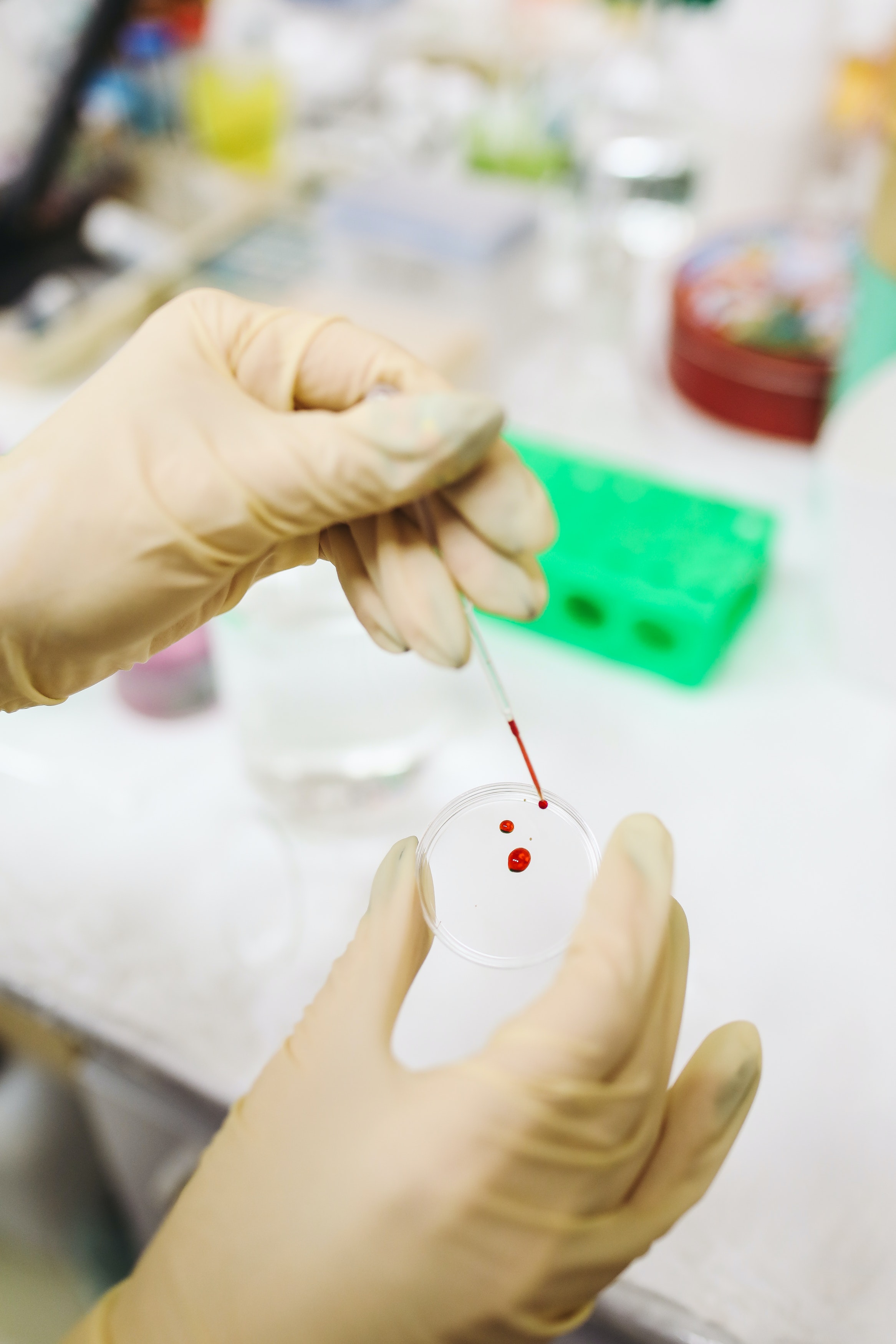 Blood Test Photo, Download The BEST Free Blood Test & HD Image
