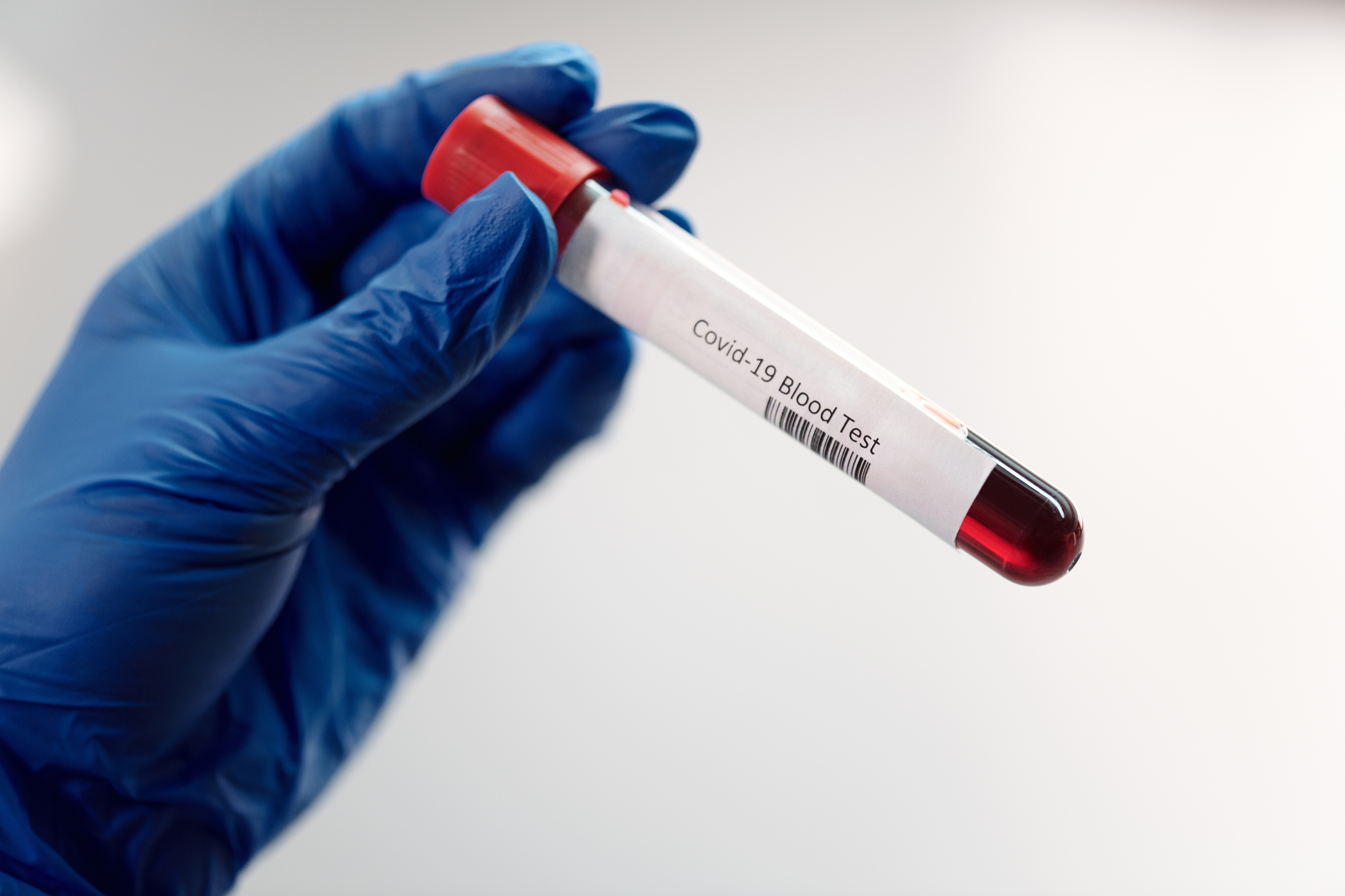 Blood Test Photo, Download The BEST Free Blood Test & HD Image