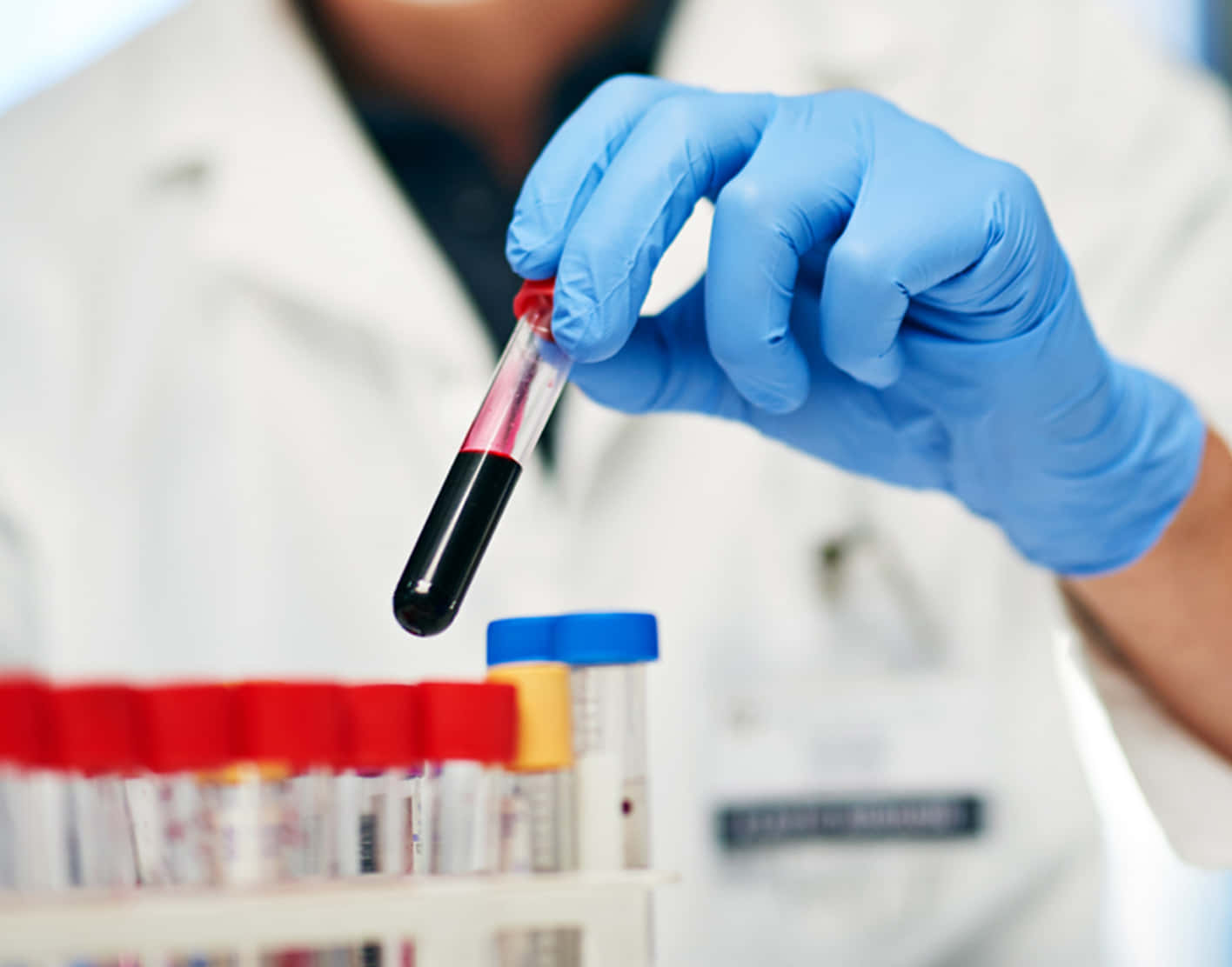 Download Laboratory Blood Filled Testing Tube Wallpaper