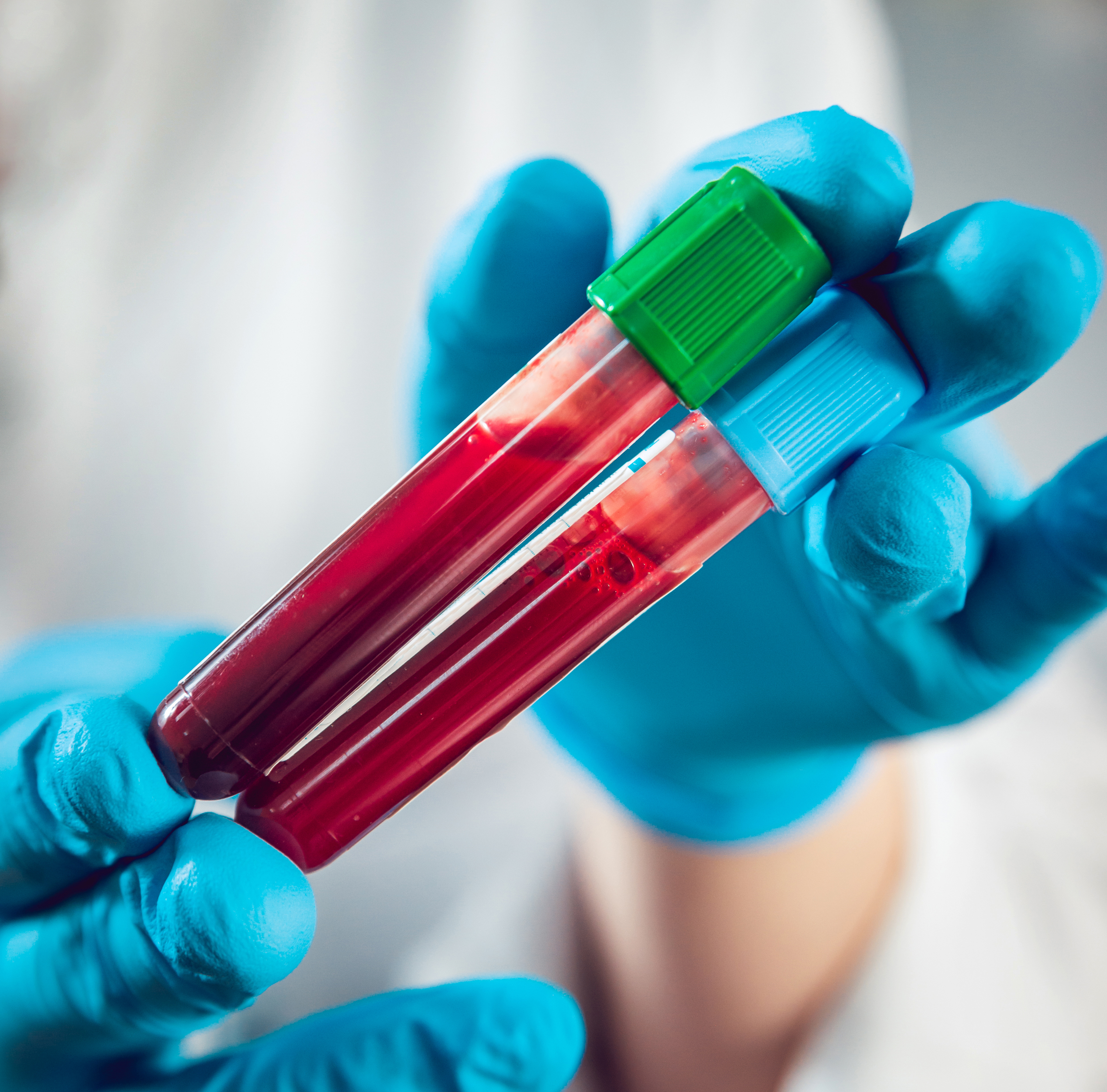 RNA blood test for fibromyalgia launched