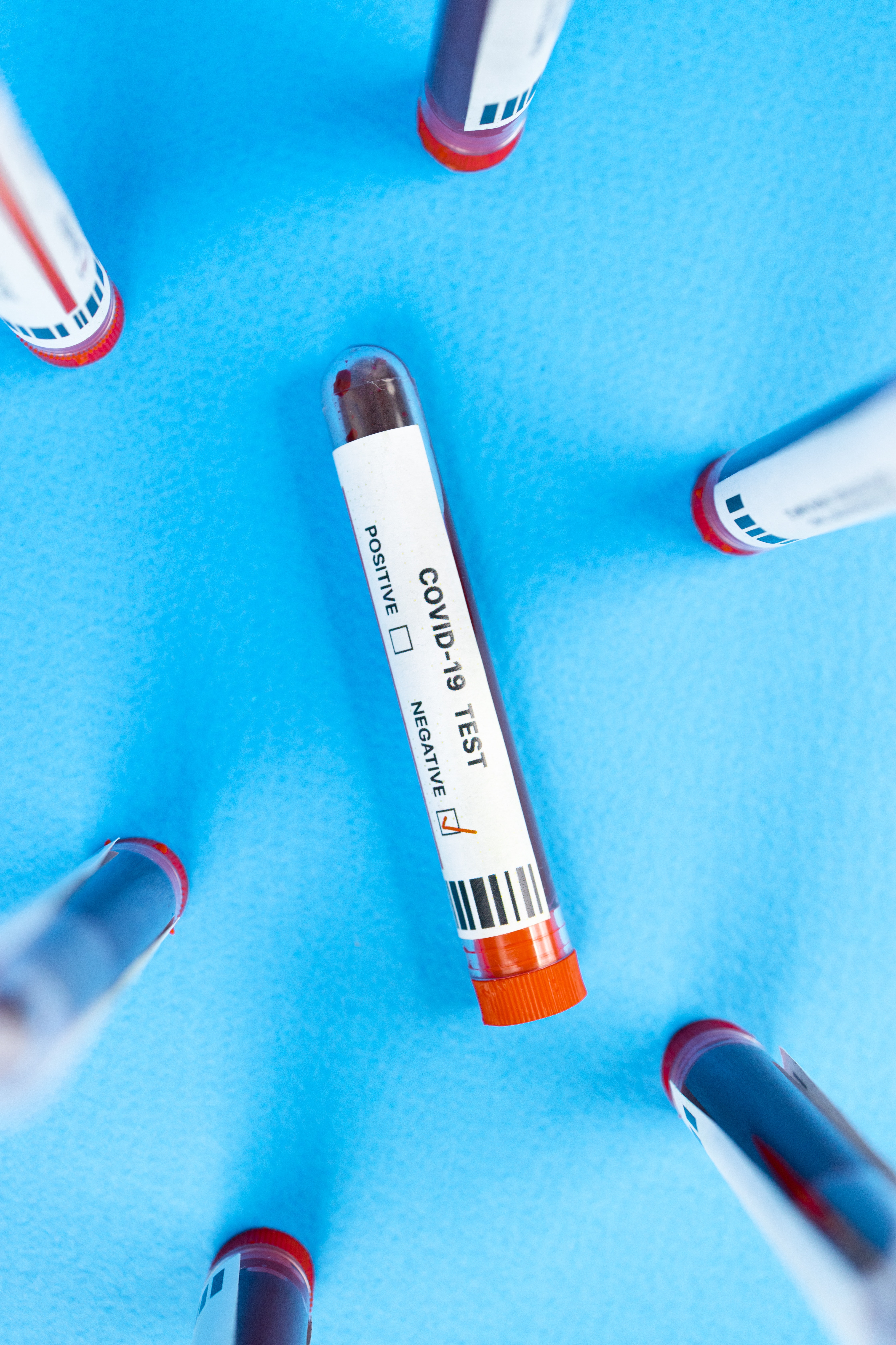 Blood Sample Photo, Download The BEST Free Blood Sample & HD Image