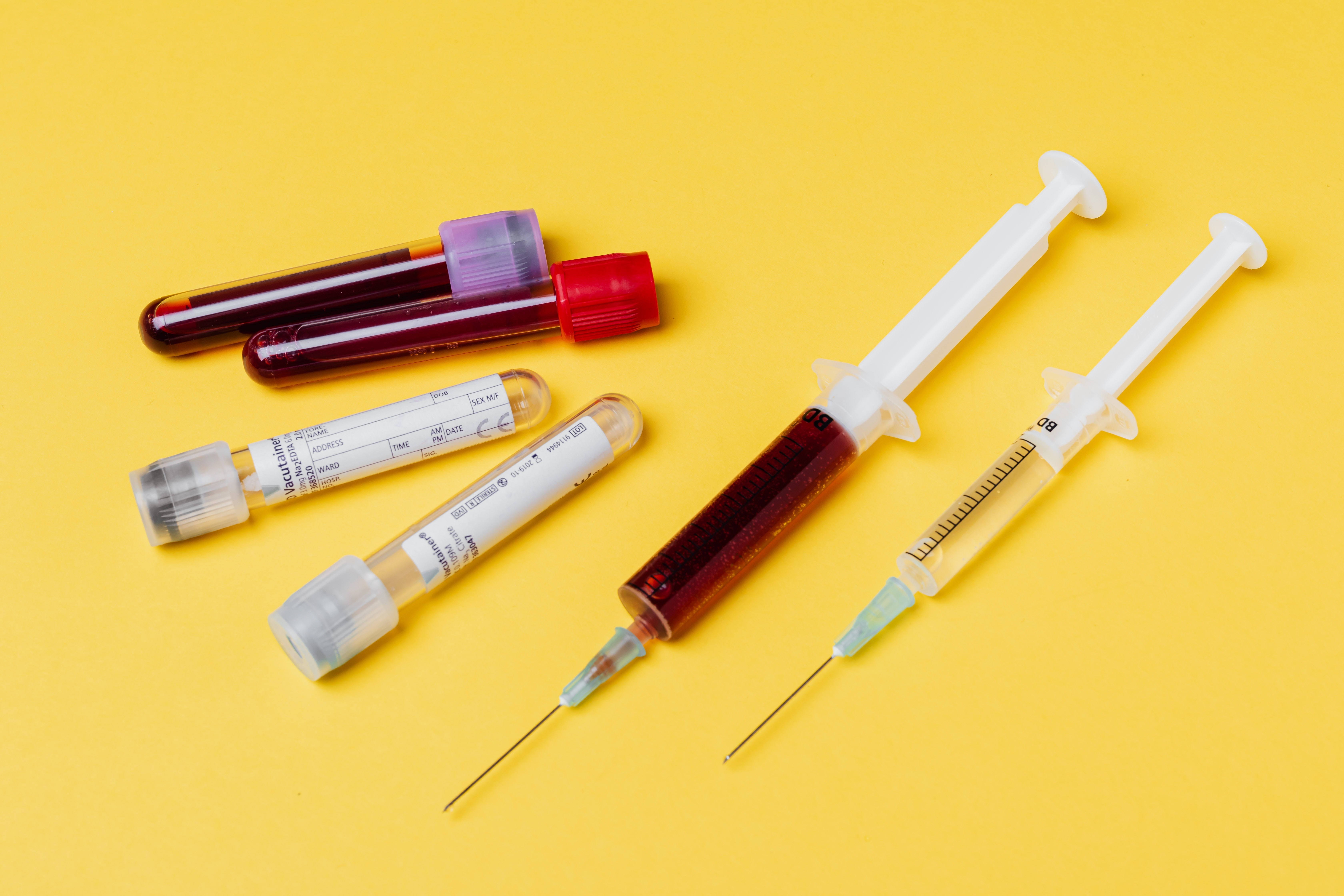 Syringes and test tubes with blood samples · Free