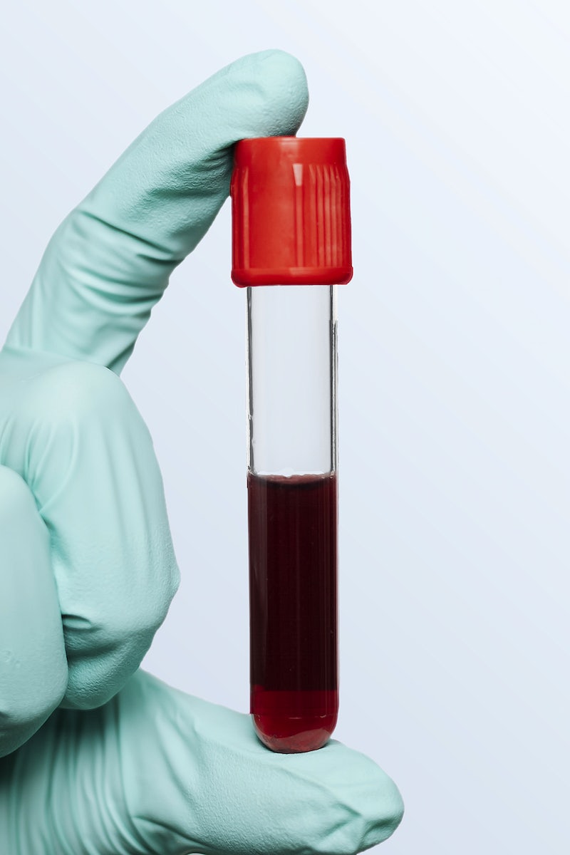 Blood Test Image Wallpaper