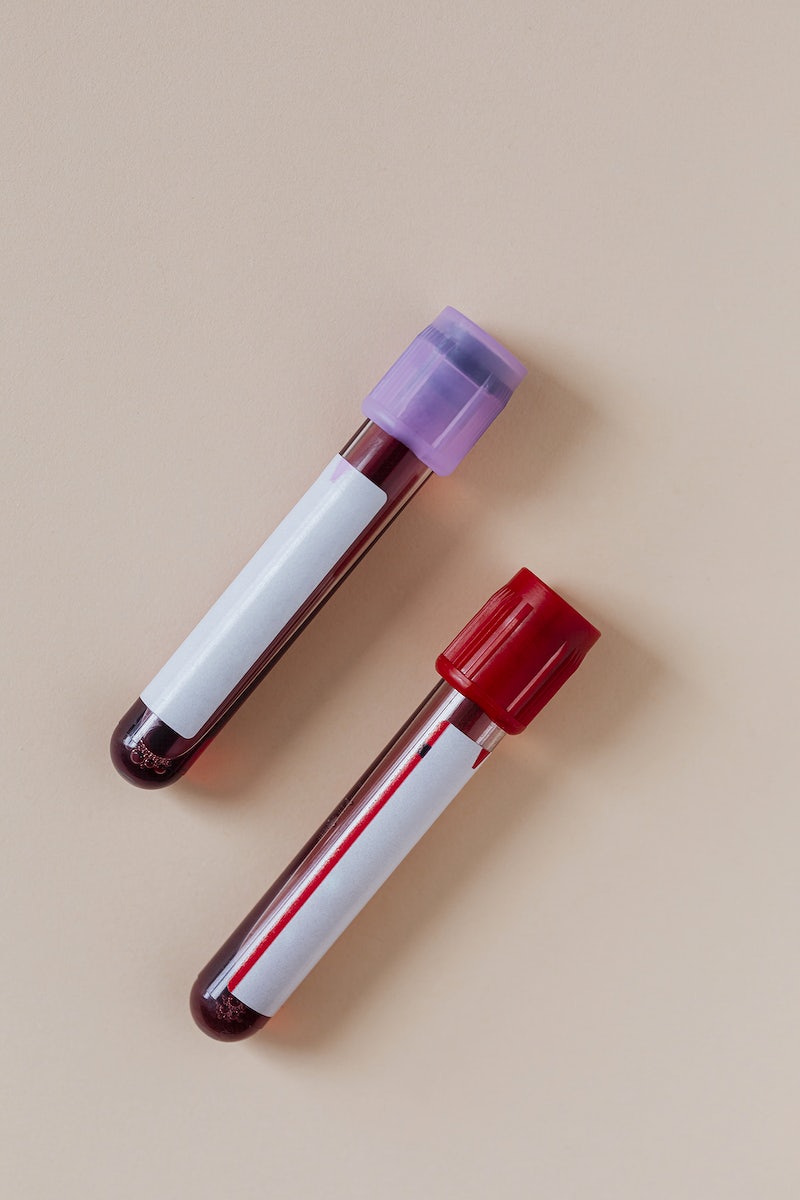Blood Test Image Wallpaper