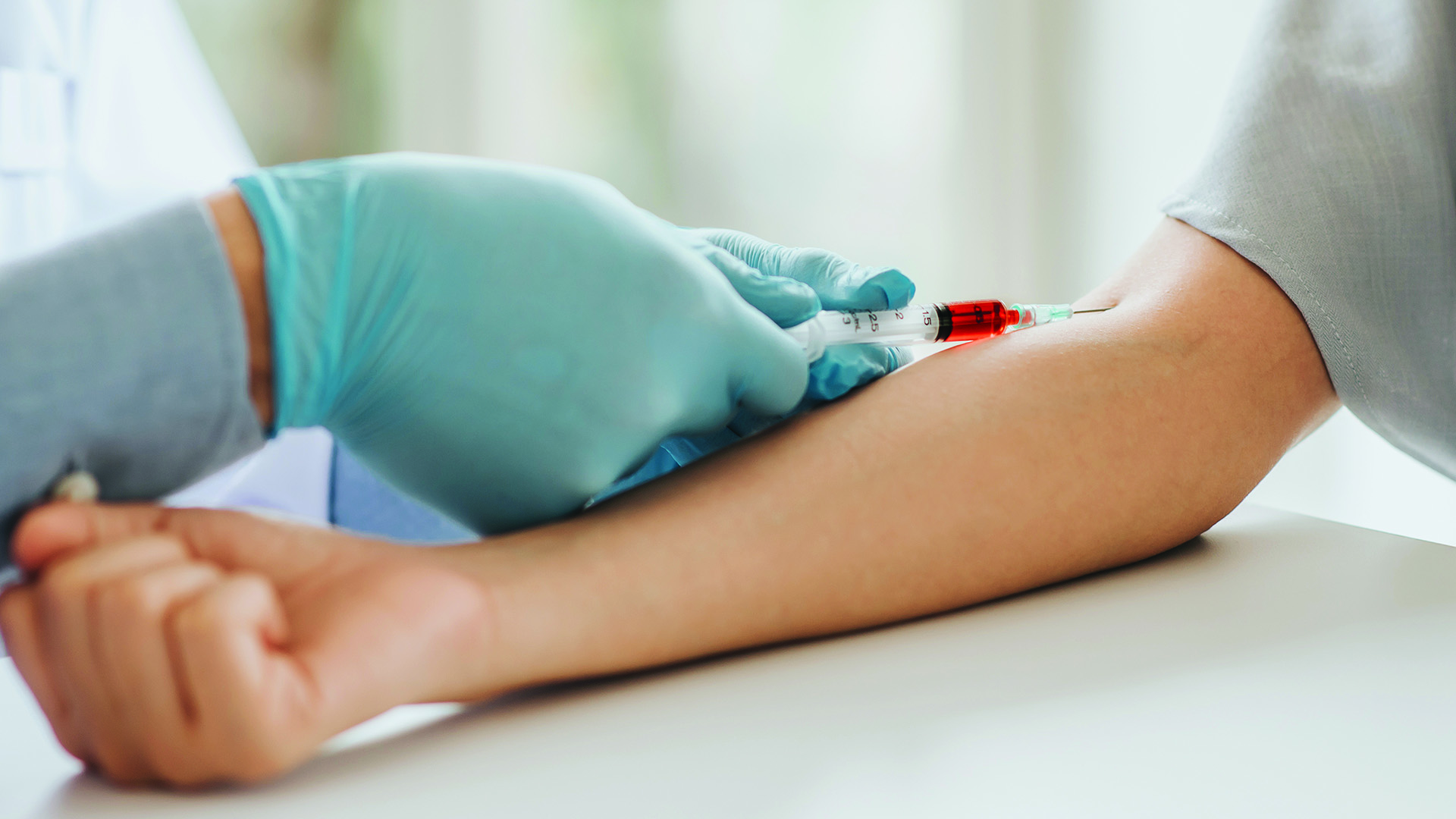 NHS launches world's largest blood test trial to detect cancer earlier Castle Lung Cancer Foundation