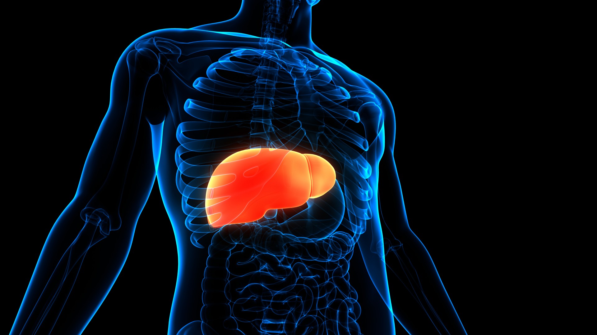 Study Reveals How Fatty Liver Promotes Colorectal Cancer Spread