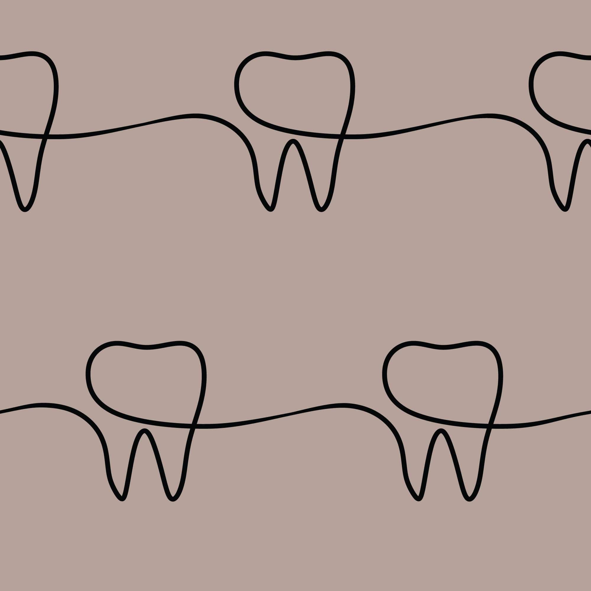 Ready To Learn What A Typical Full Mouth Dental Implant Procedure Looks  Like? | State of the Art Dental Group