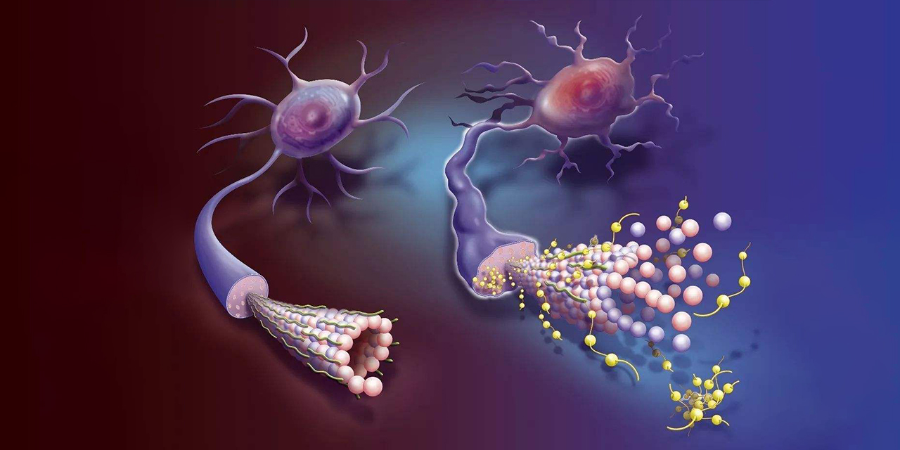 Metabolism Archives ELISA Kit. FineTest Antibody. Wuhan Fine Biotech Co., Ltd