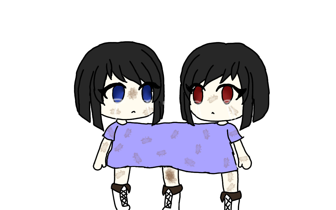 Conjoined twins edit
