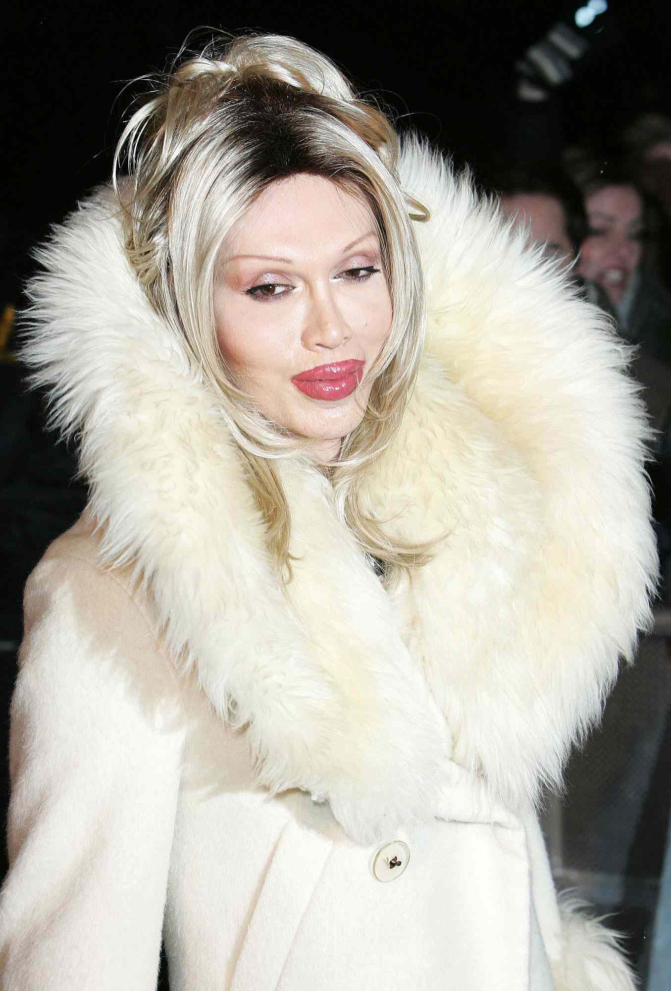 Pete Burns Dead: His Changing Appearancers