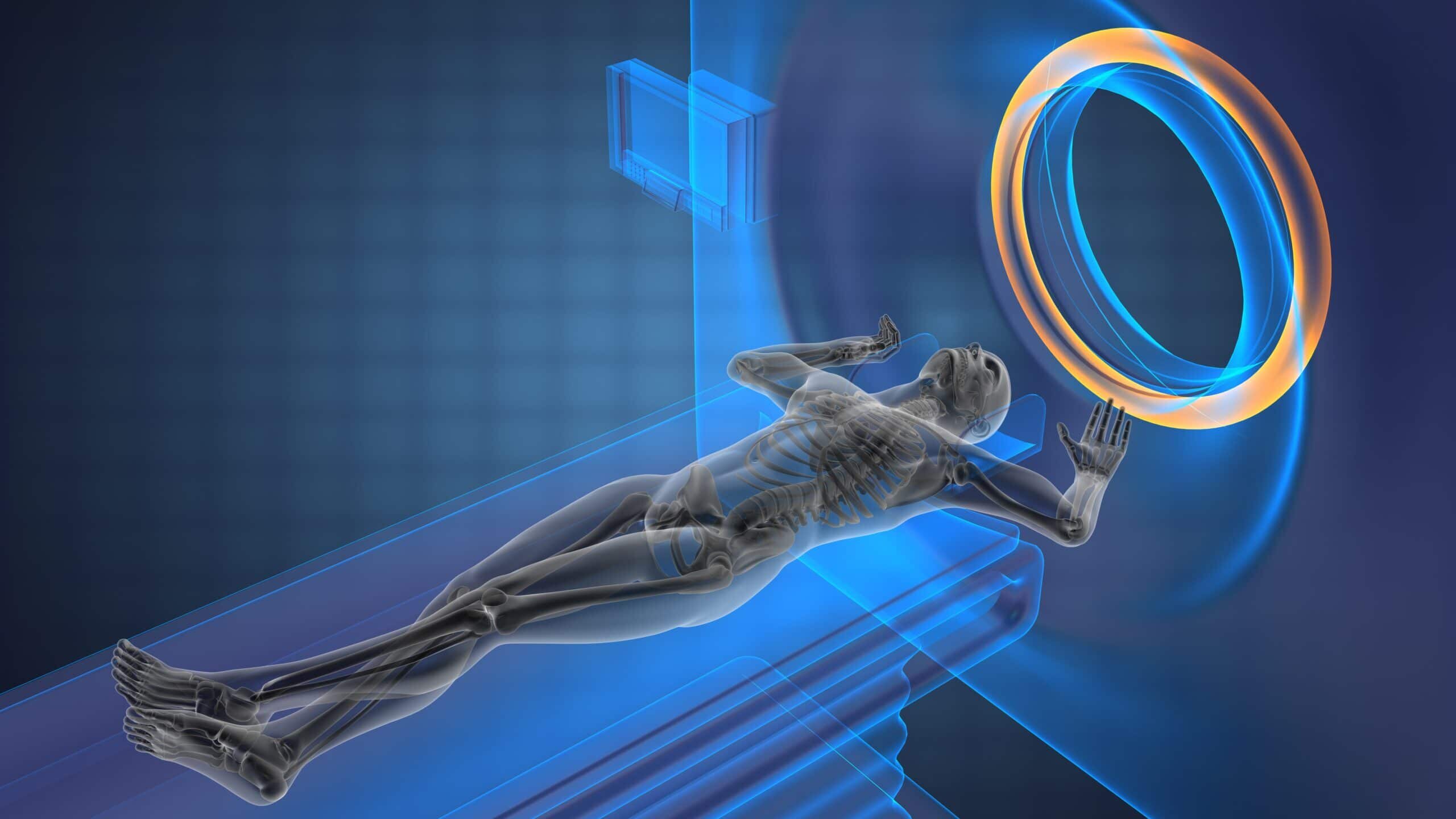 Magnetic Resonance Imaging: Body MRI