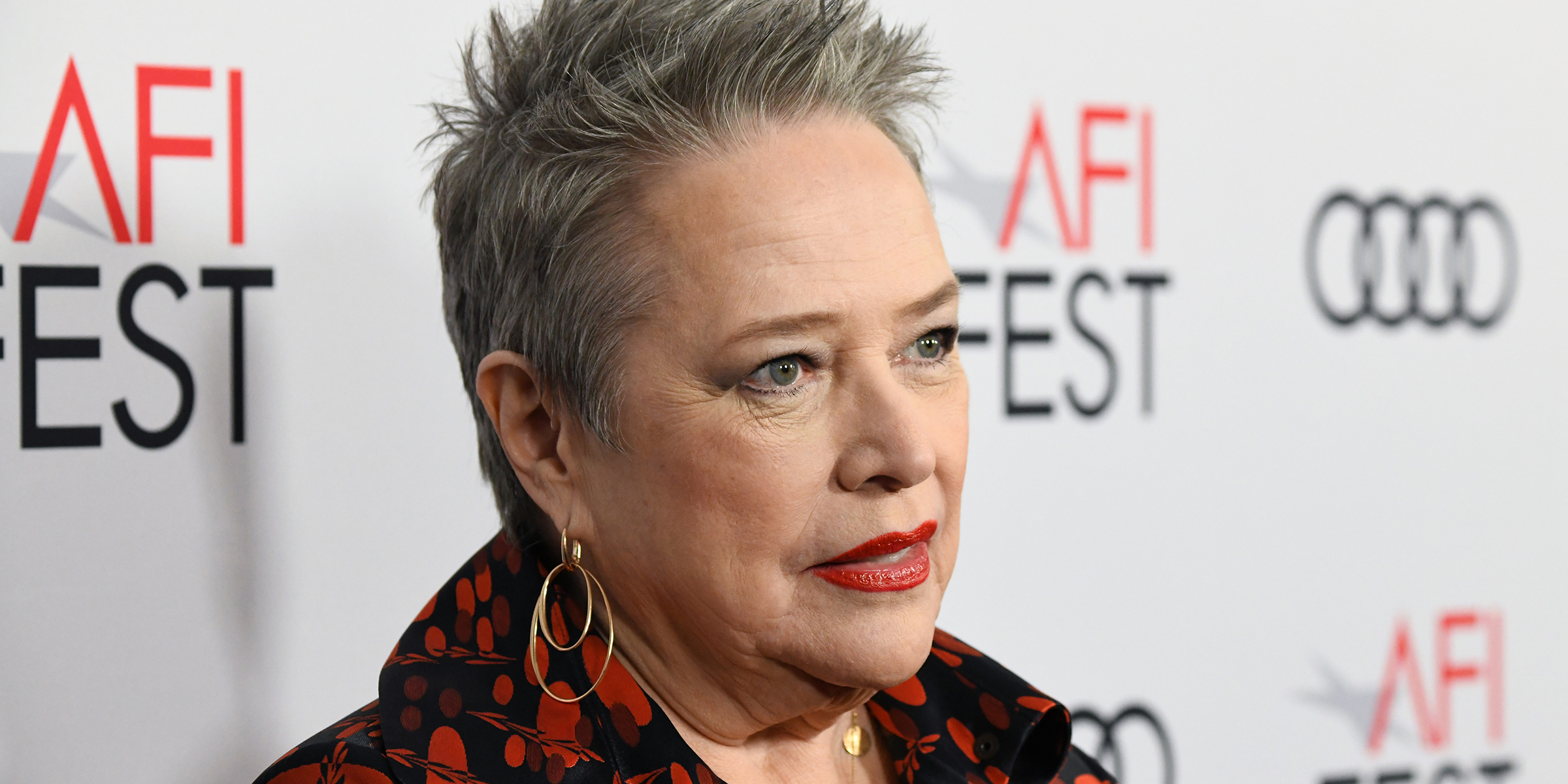 Kathy Bates talks lymphedema and double