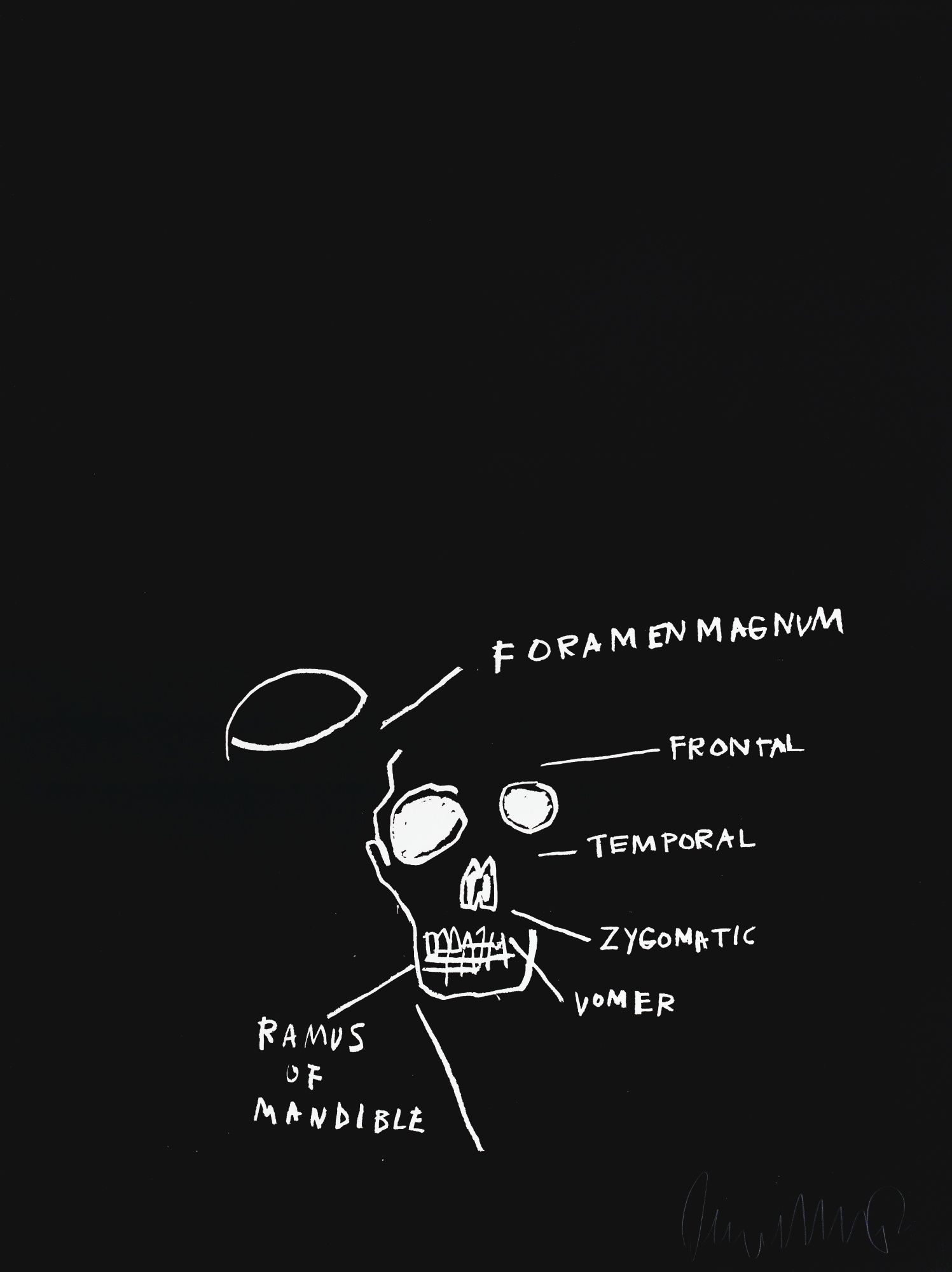 Jean Michel Basquiat: Untitled Skull