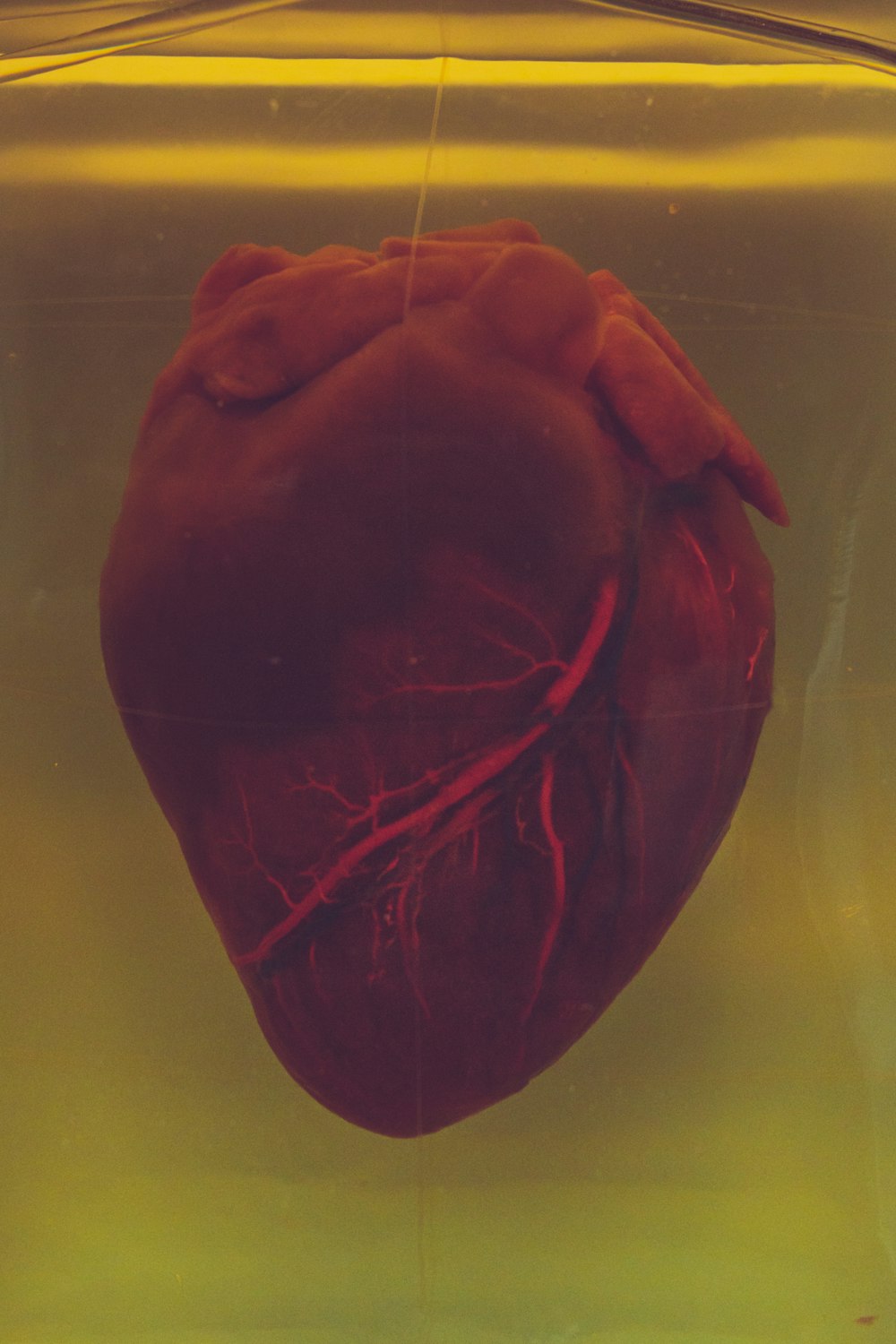 Heart Organ Picture. Download Free