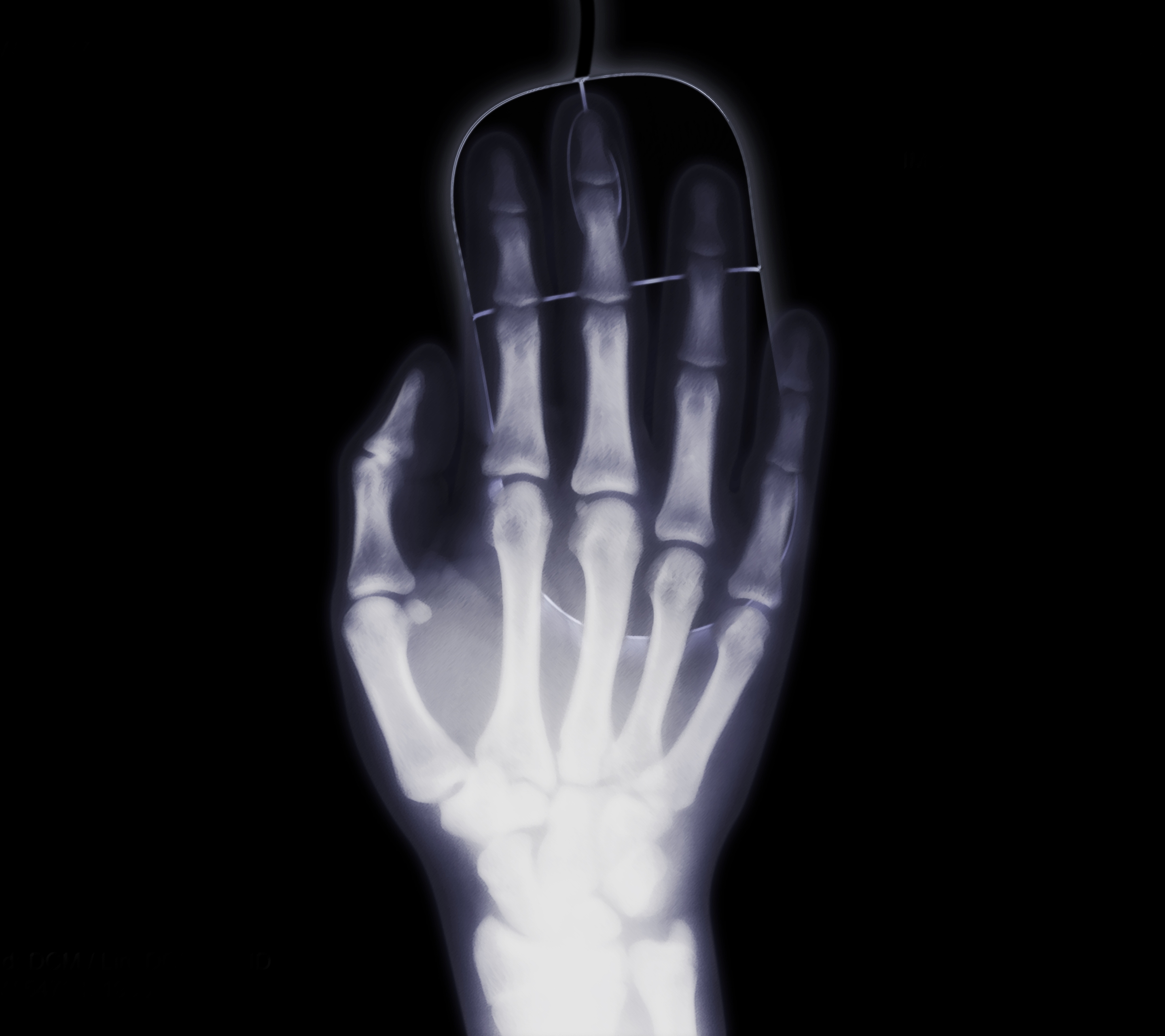 HD desktop wallpaper: Hand, X Ray