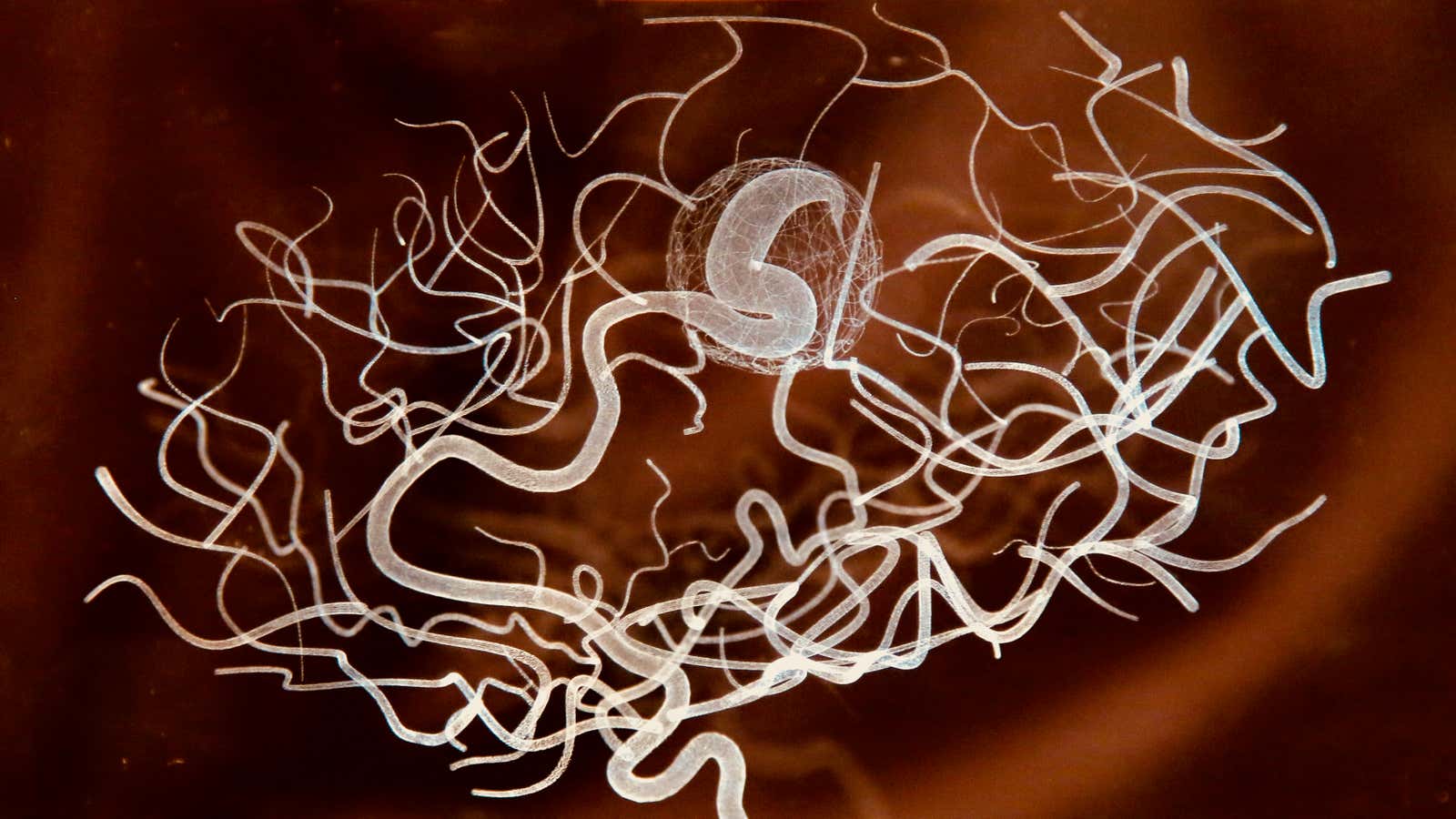 A neuroscientist who lost her mind says