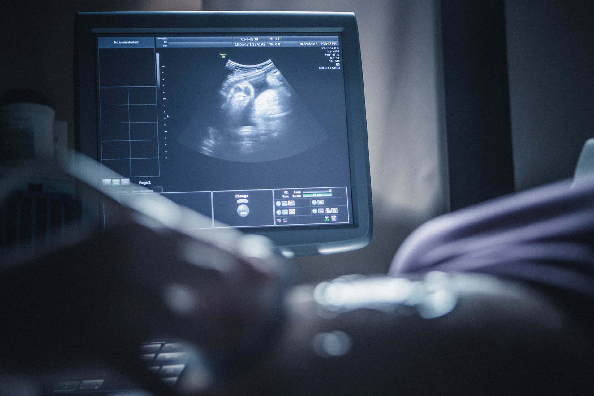 Ultrasound Picture