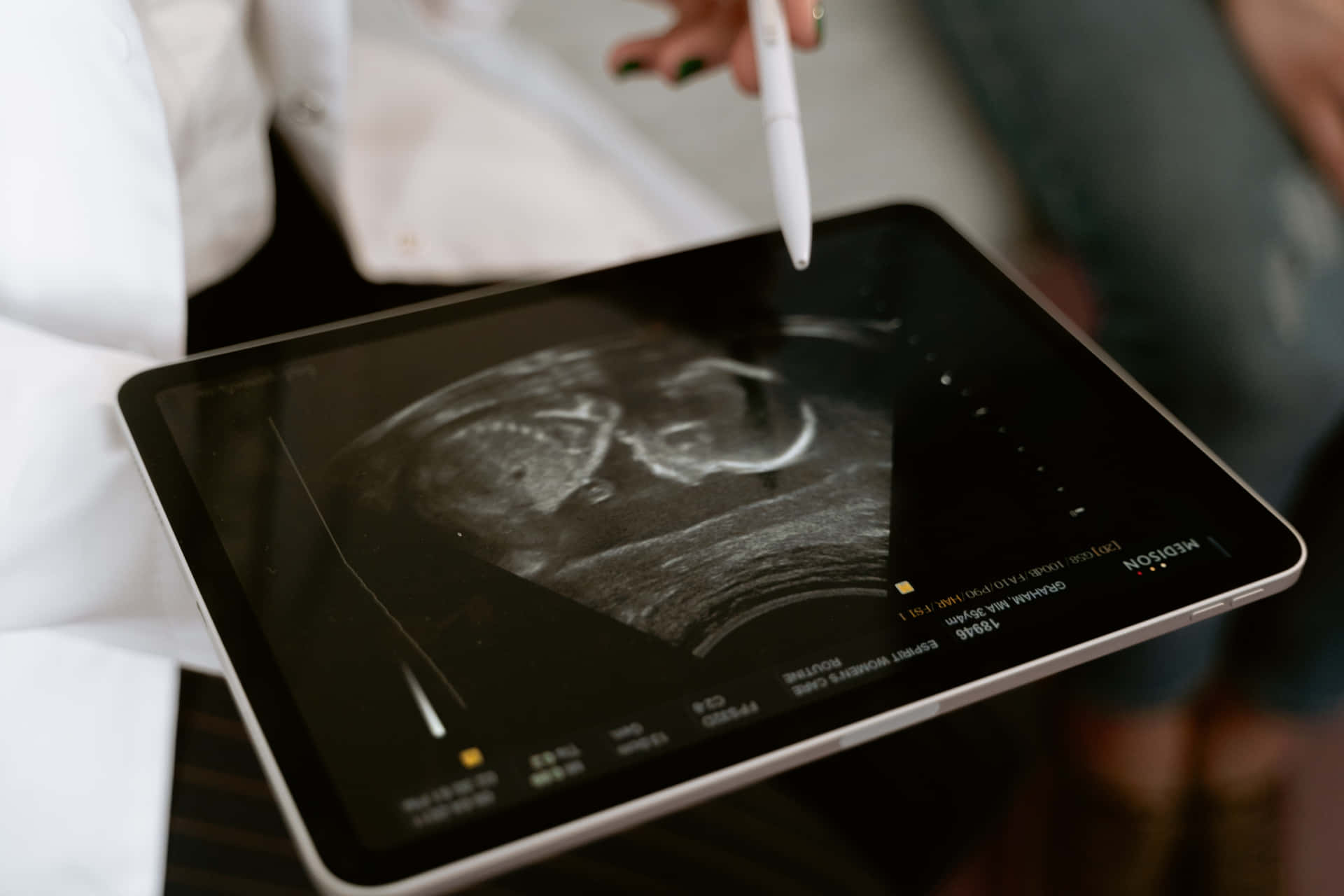 Ultrasound Picture
