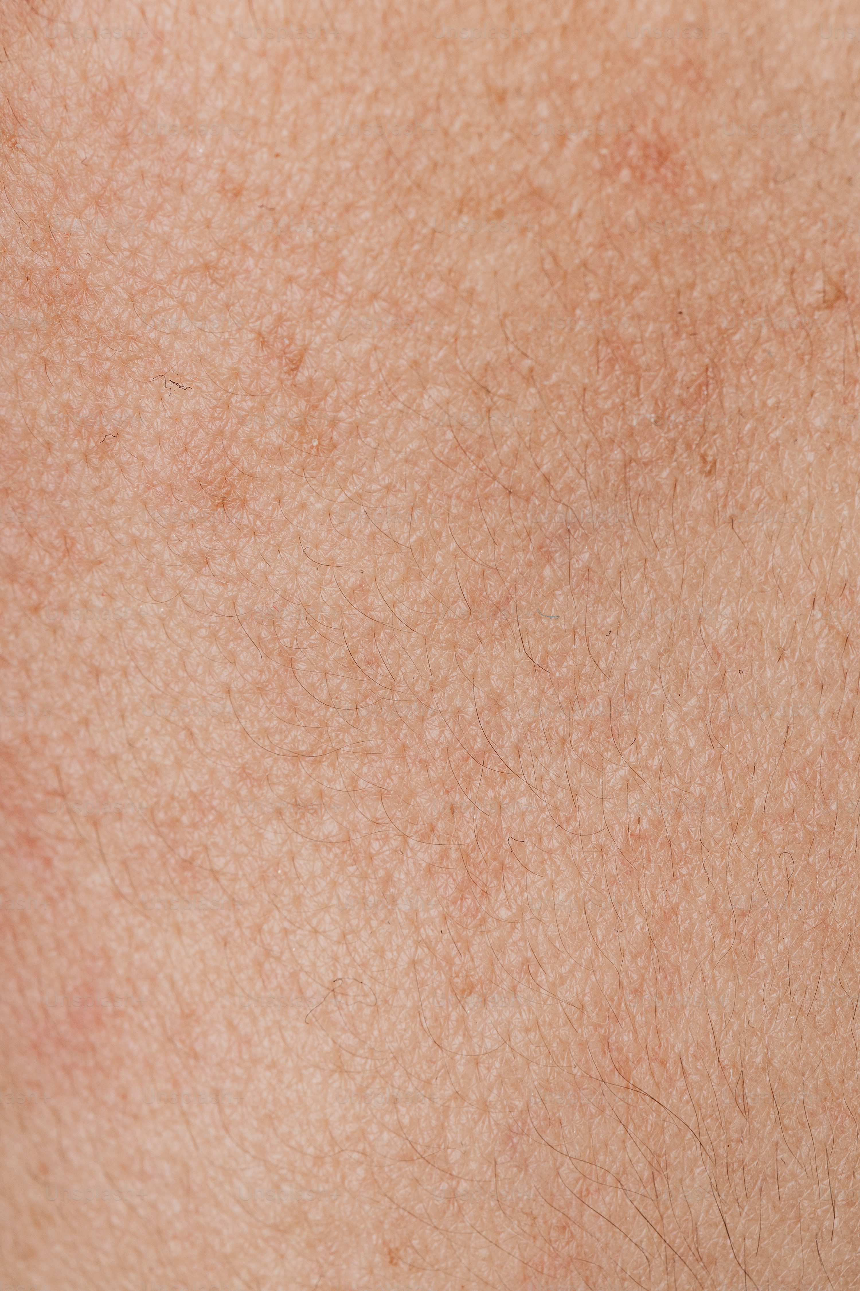 Skin Texture Picture HD