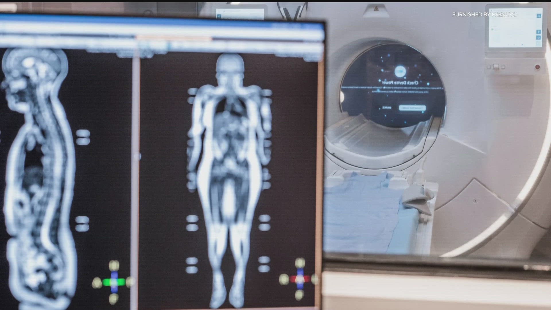 Full Body MRIs: A Board Certified