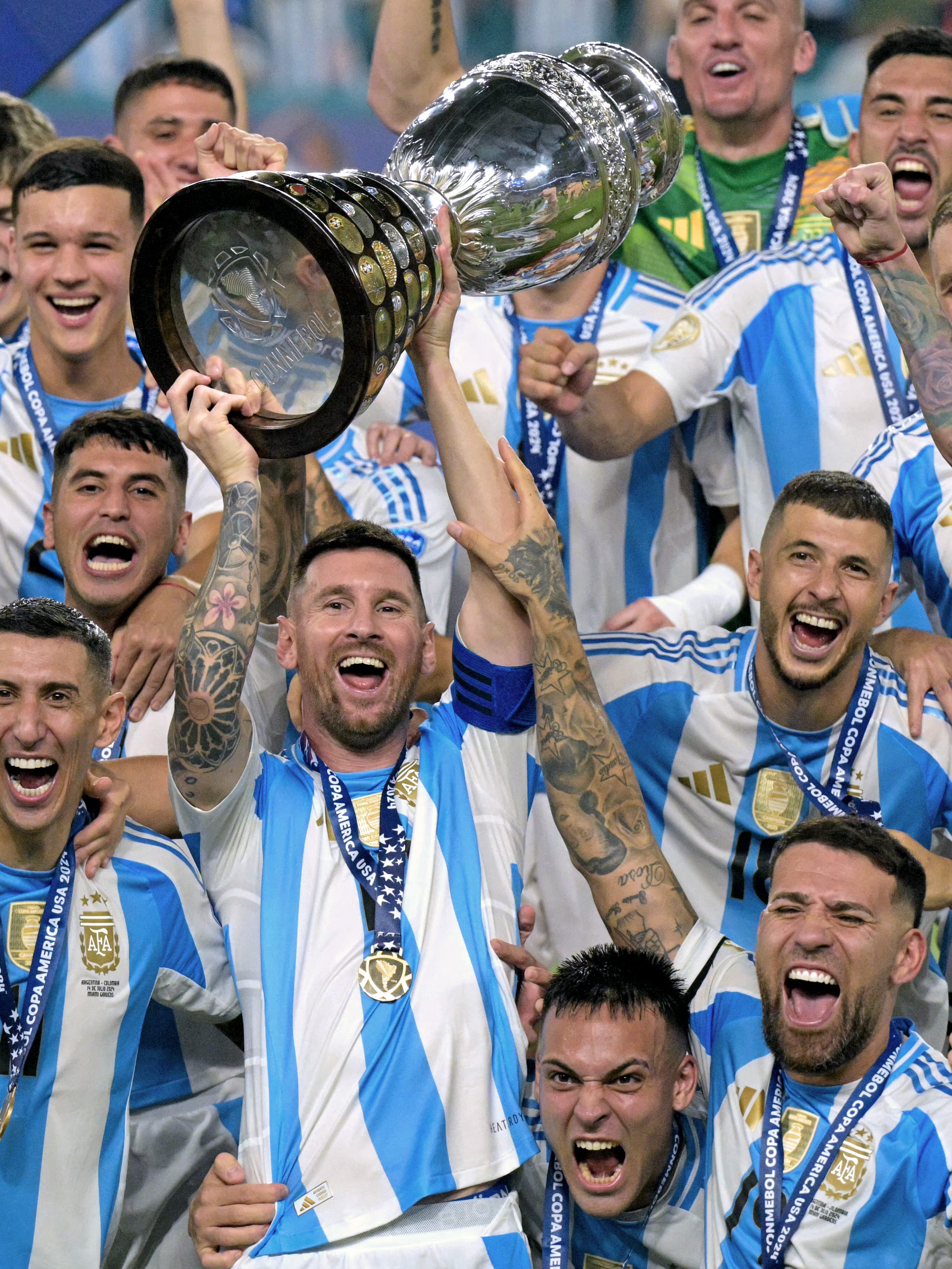 Copa America: Messi hurt, Argentina