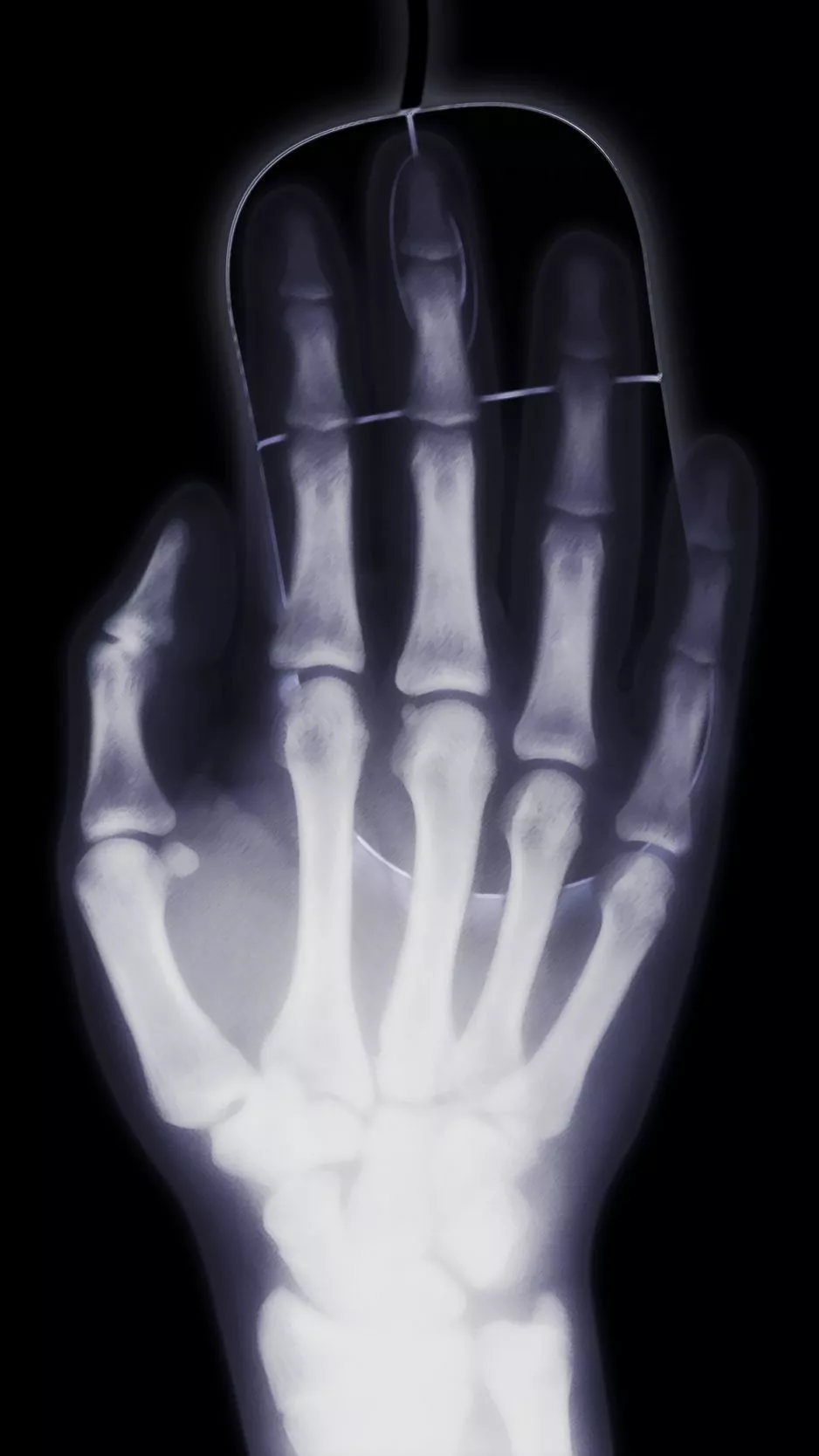 Download Wallpaper 938x1668 Arm, X Ray